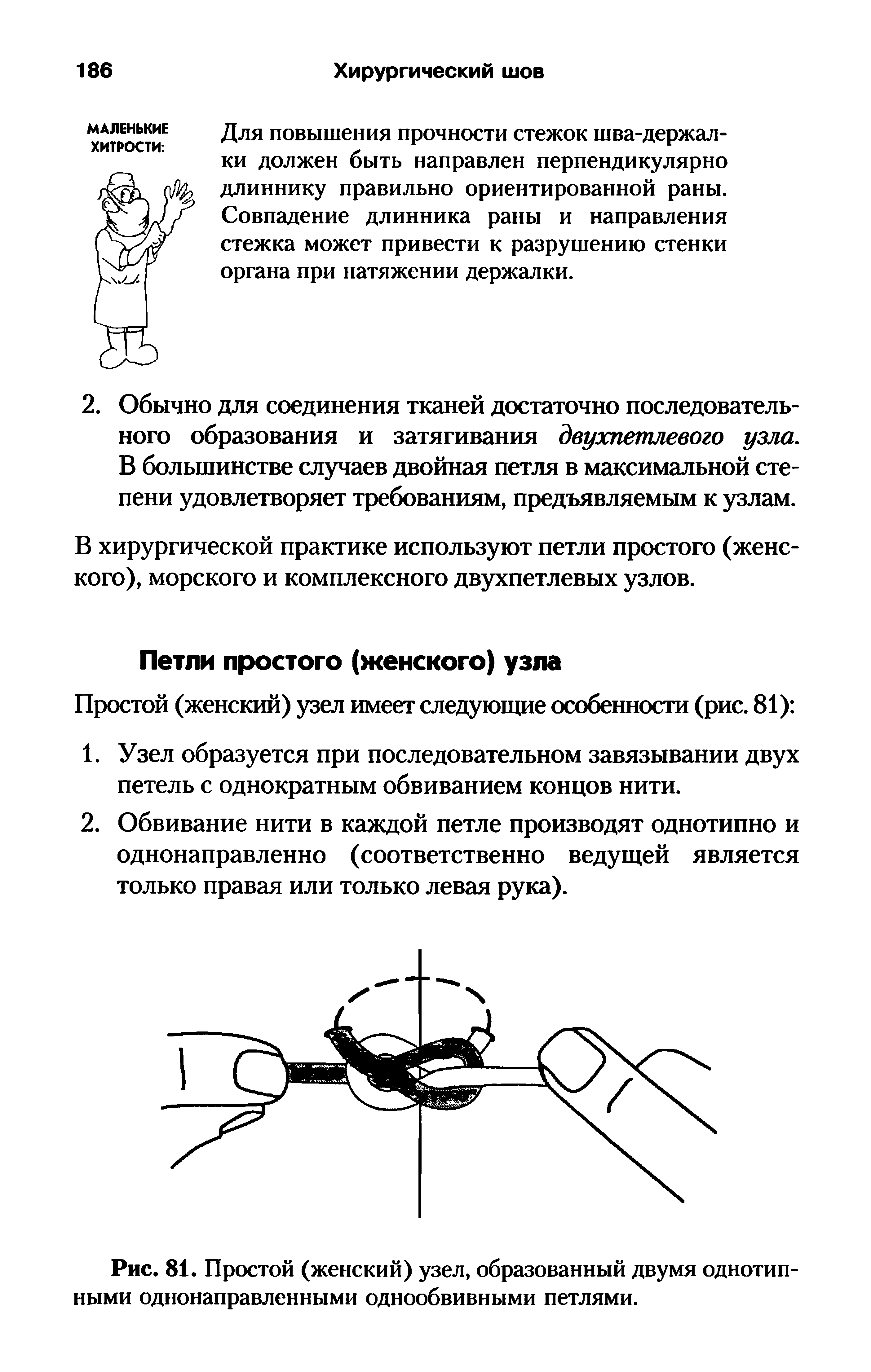 Рис. 81. Простой (женский) узел, образованный двумя однотип ными однонаправленными однообвивными петлями.