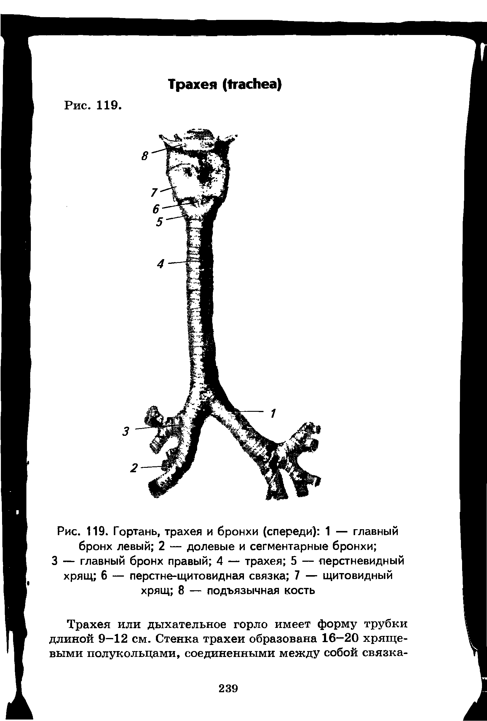 Рис. 119. Гортань, трахея и бронхи (спереди) 1 — главный бронх левый 2 — долевые и сегментарные бронхи ...