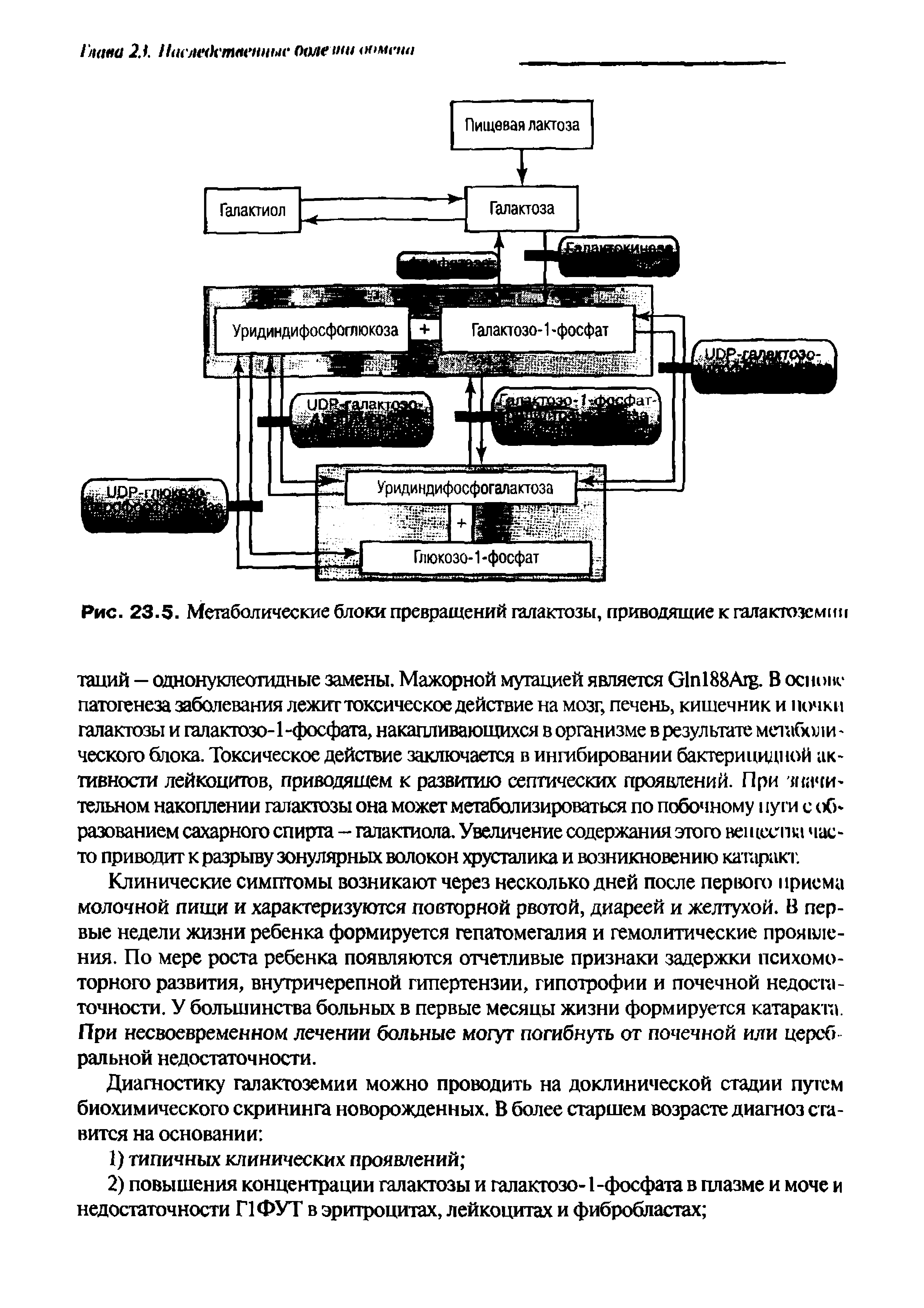 Рис. 23.5. Метаболические блоки превращений галактозы, приводящие к галактоземии...