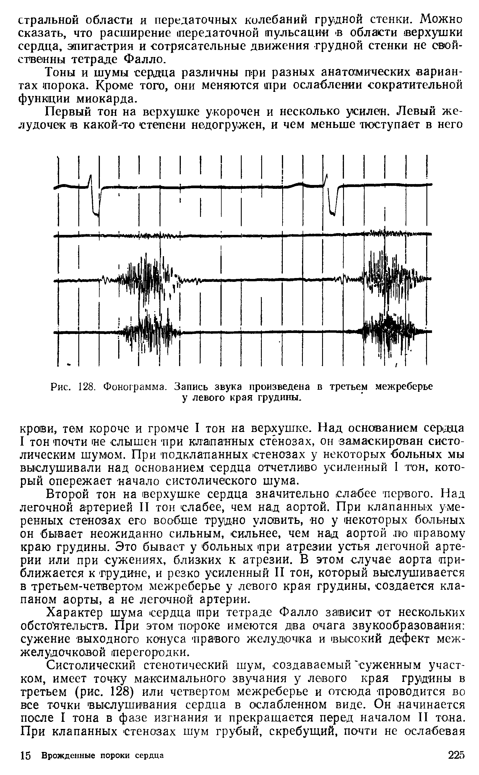 Рис. 128. Фонограмма. Запись звука произведена в третьем межреберье у левого края грудины.