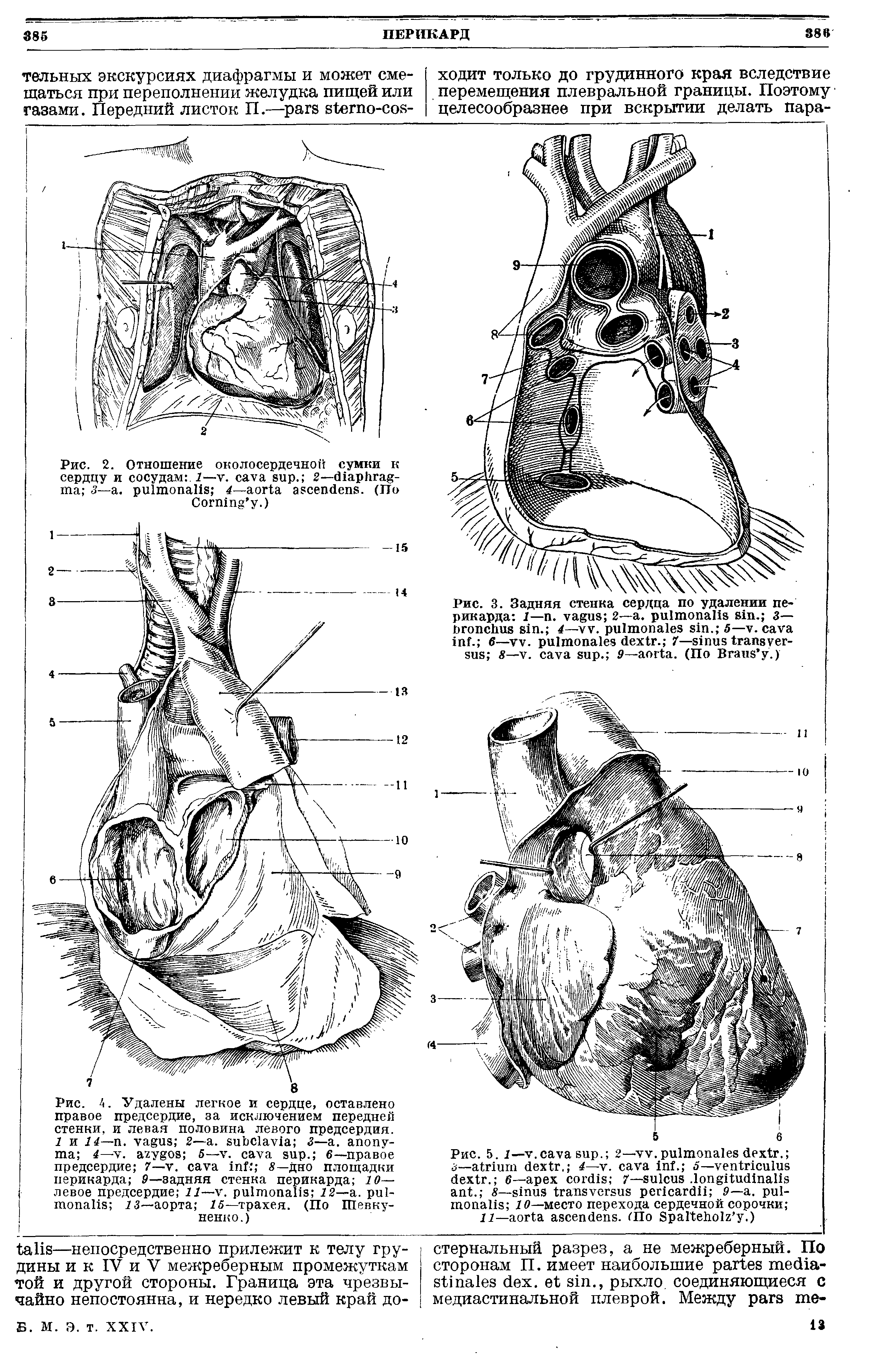 Рис. 2. Отношение околосердечной сумки к сердцу и сосудам . — . . 2— 3— . 4— . (По C .)...