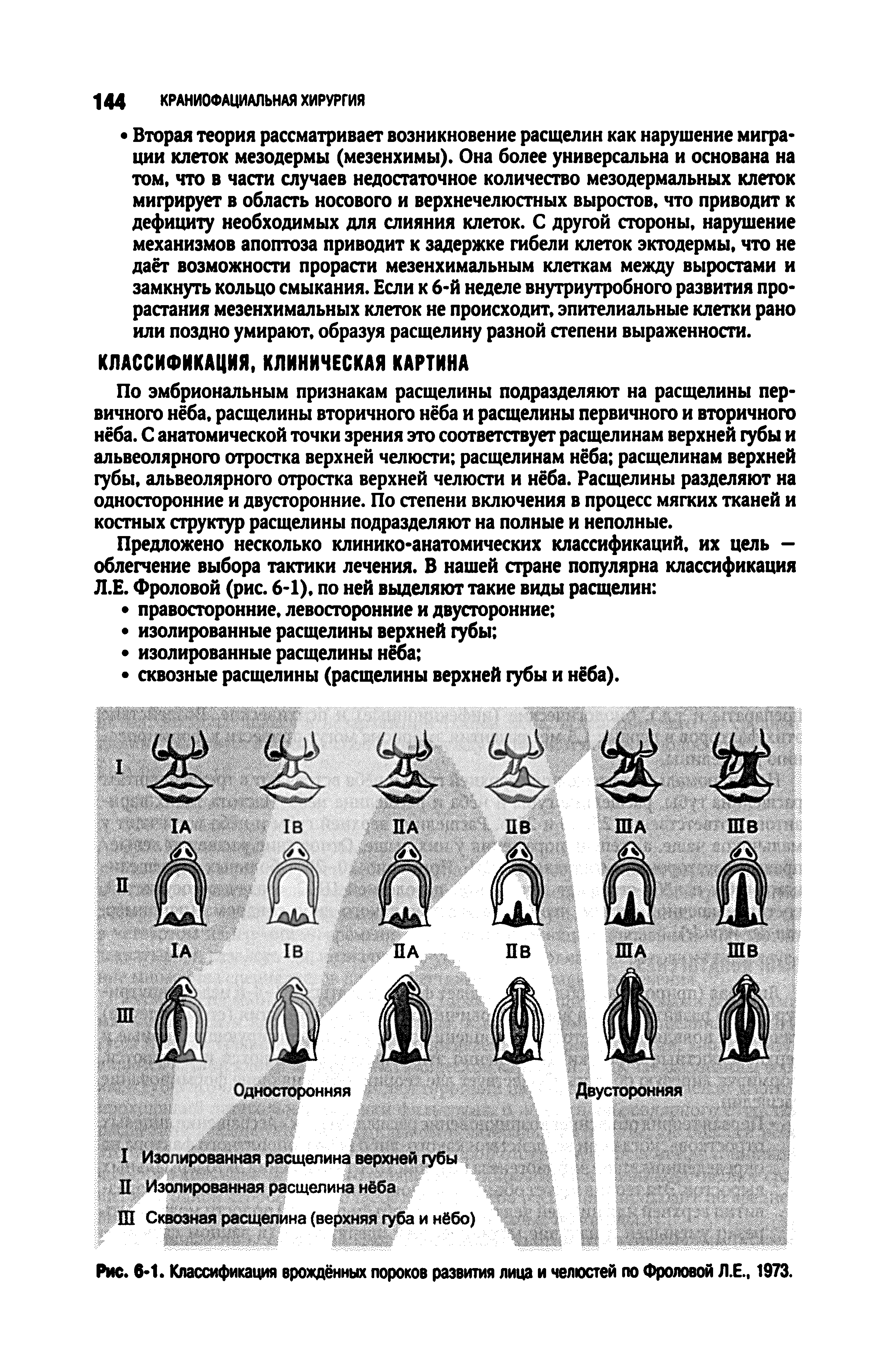 Рис. 6-1. Классификация врождённых пороков развития лица и челюстей по Фроловой Л.Е., 1973.