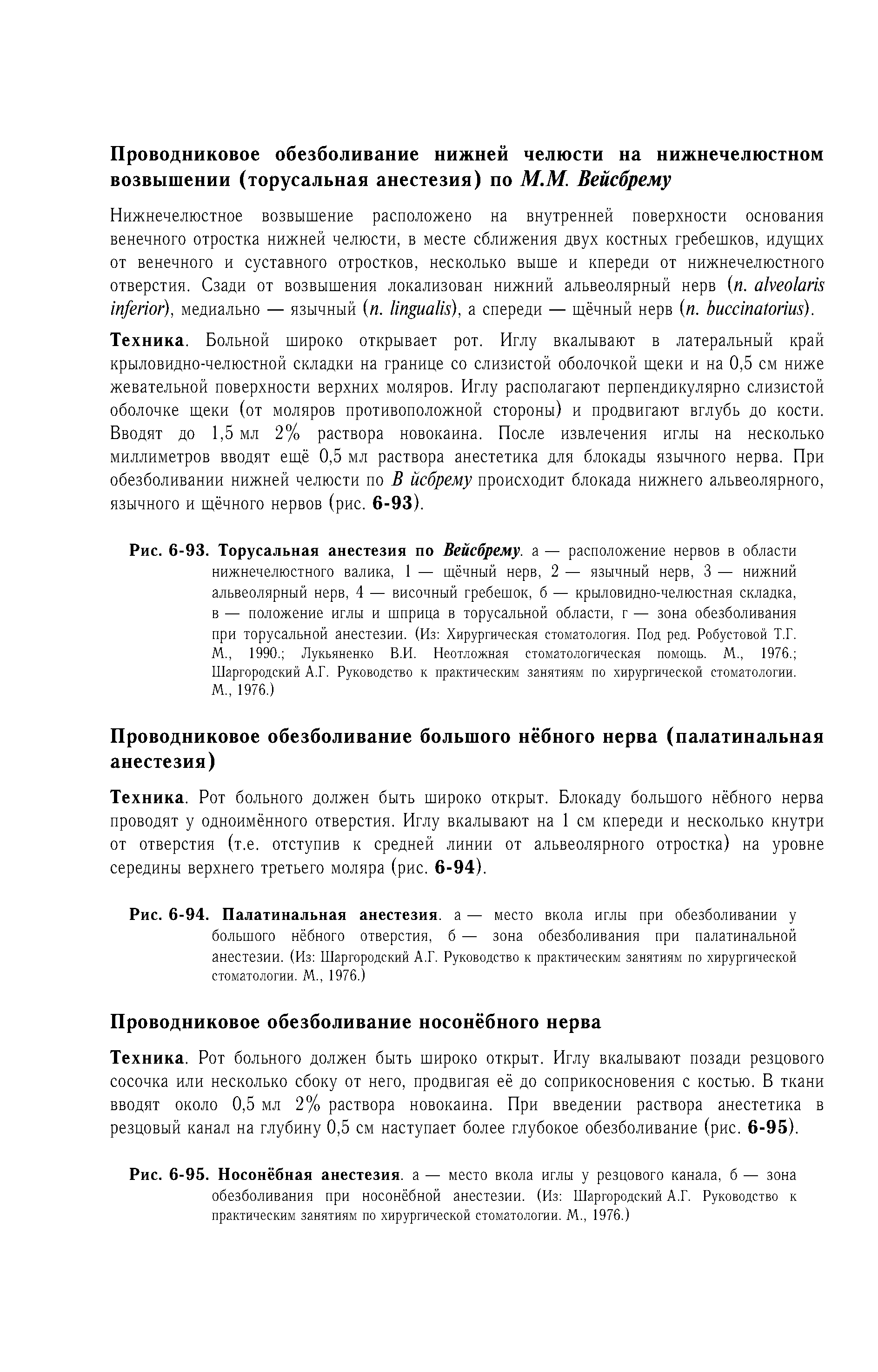 Рис. 6-93. Торусальная анестезия по Вейсбрему. а — расположение нервов в области нижнечелюстного валика, 1 — щёчный нерв, 2 — язычный нерв, 3 — нижний альвеолярный нерв, 4 — височный гребешок, б — крыловидно-челюстная складка, в — положение иглы и шприца в торусальной области, г — зона обезболивания при торусальной анестезии. (Из Хирургическая стоматология. Под ред. Робустовой Т.Г. М., 1990. Лукьяненко В.И. Неотложная стоматологическая помощь. М., 1976. ...