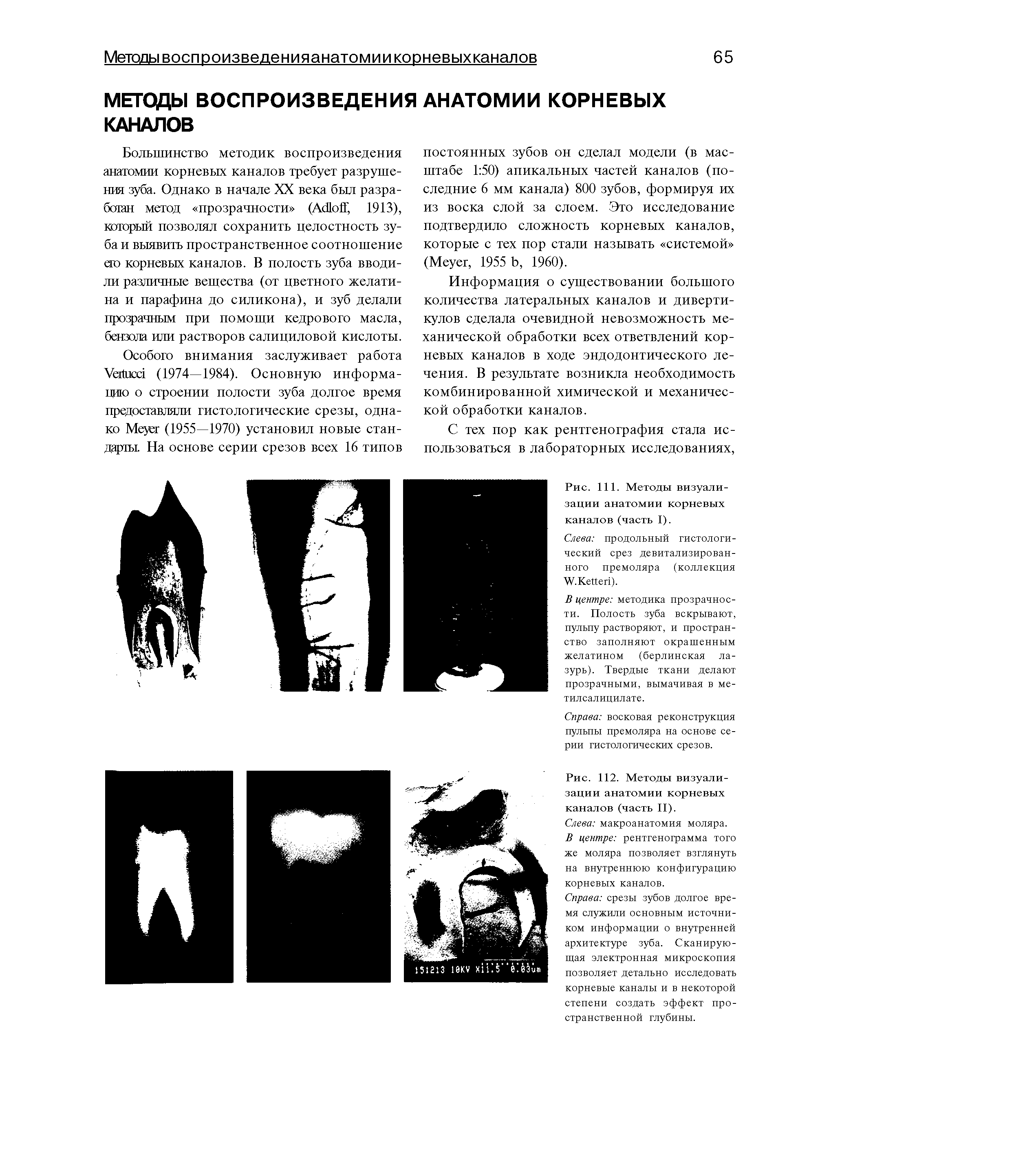 Рис. 111. Методы визуализации анатомии корневых каналов (часть I).