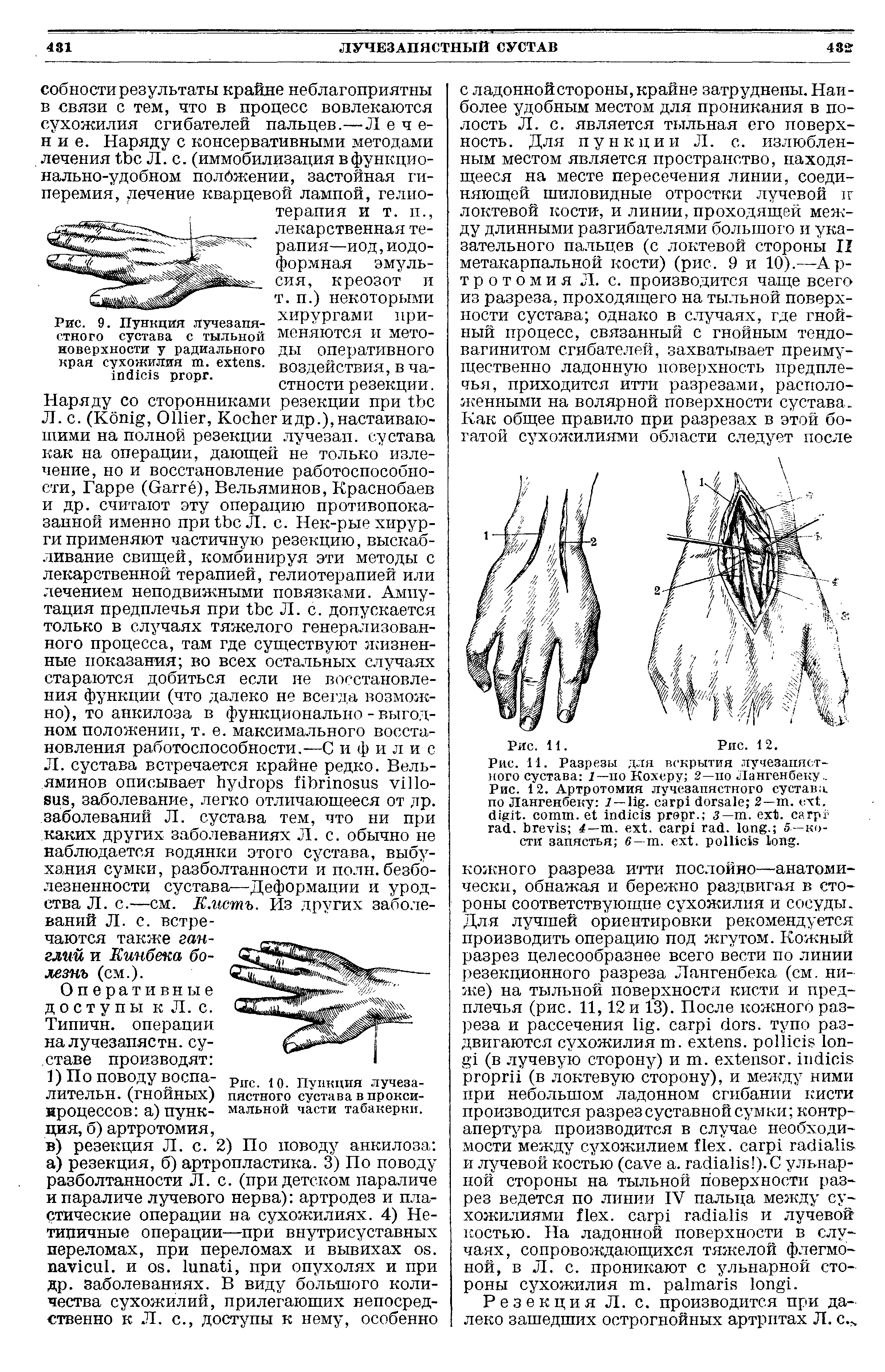 Рис. 10. Пункция лучезапястного сустава в проксимальной части табакерки.