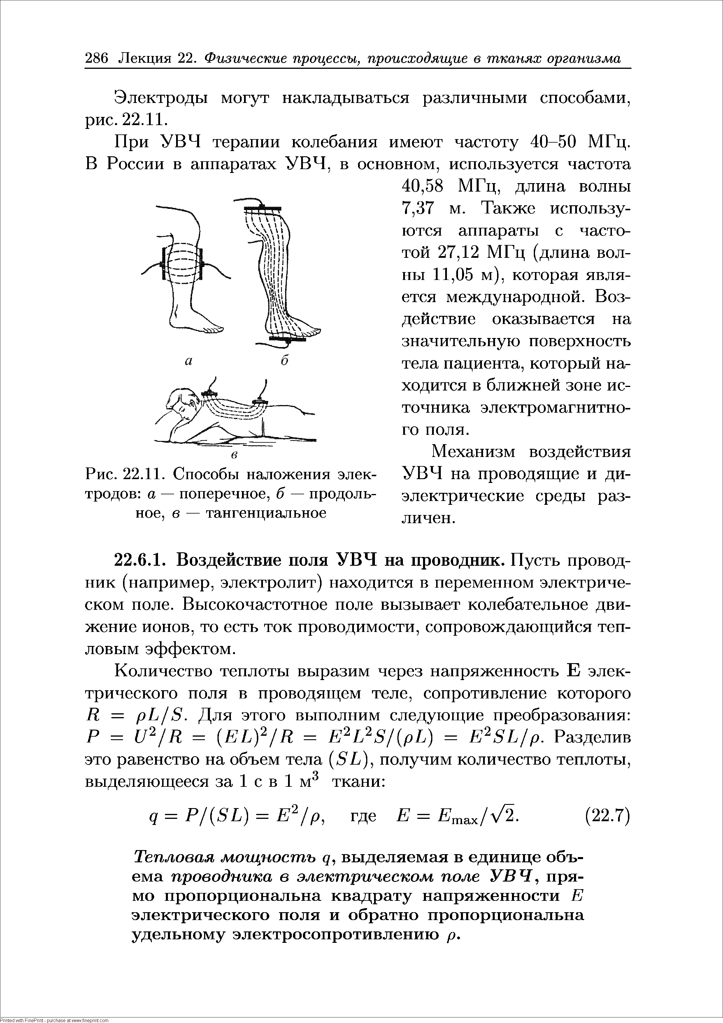 Рис. 22.11. Способы наложения электродов а — поперечное, б — продольное, в — тангенциальное...