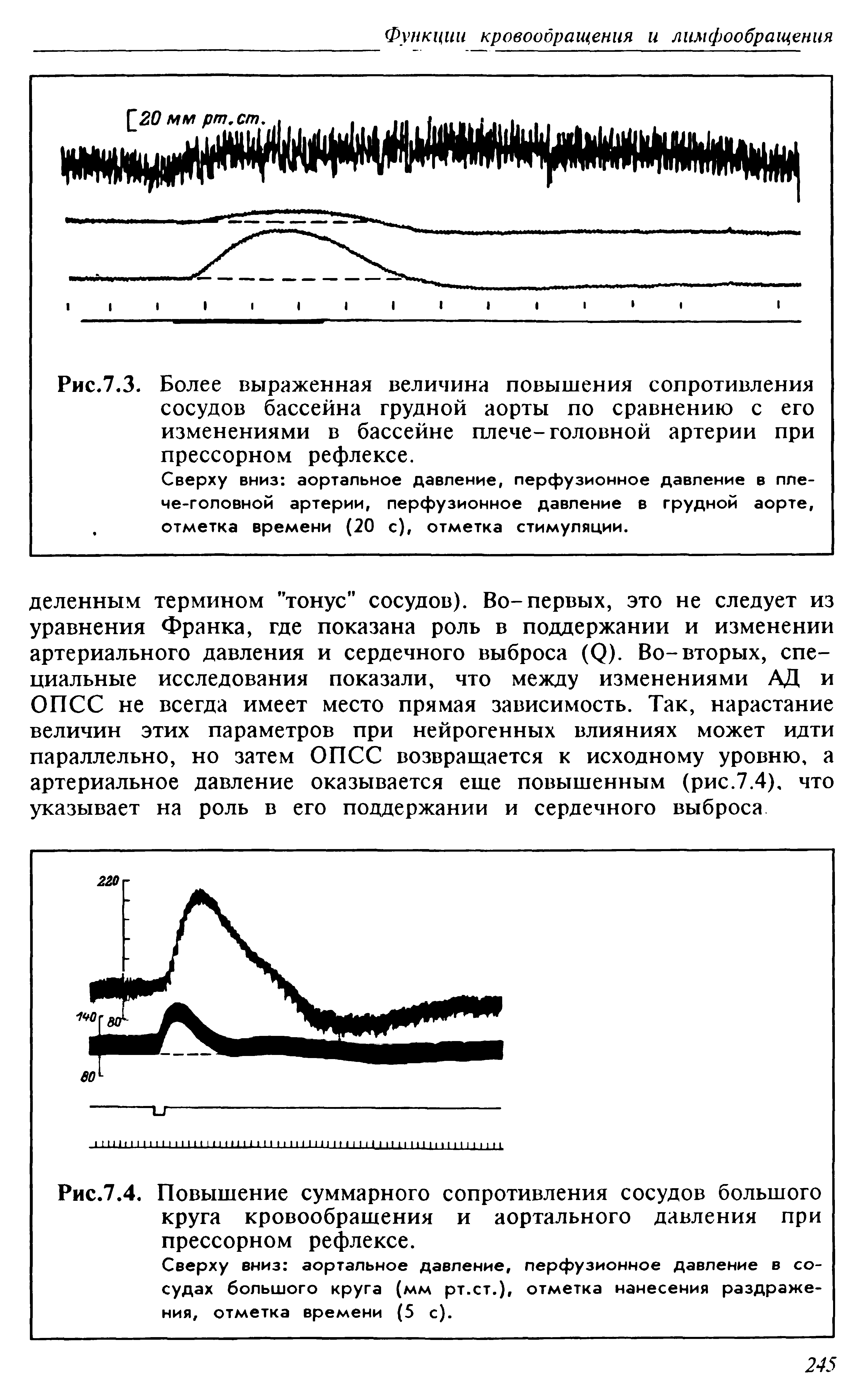 Рис.7.4. Повышение суммарного сопротивления сосудов большого круга кровообращения и аортального давления при прессорном рефлексе.