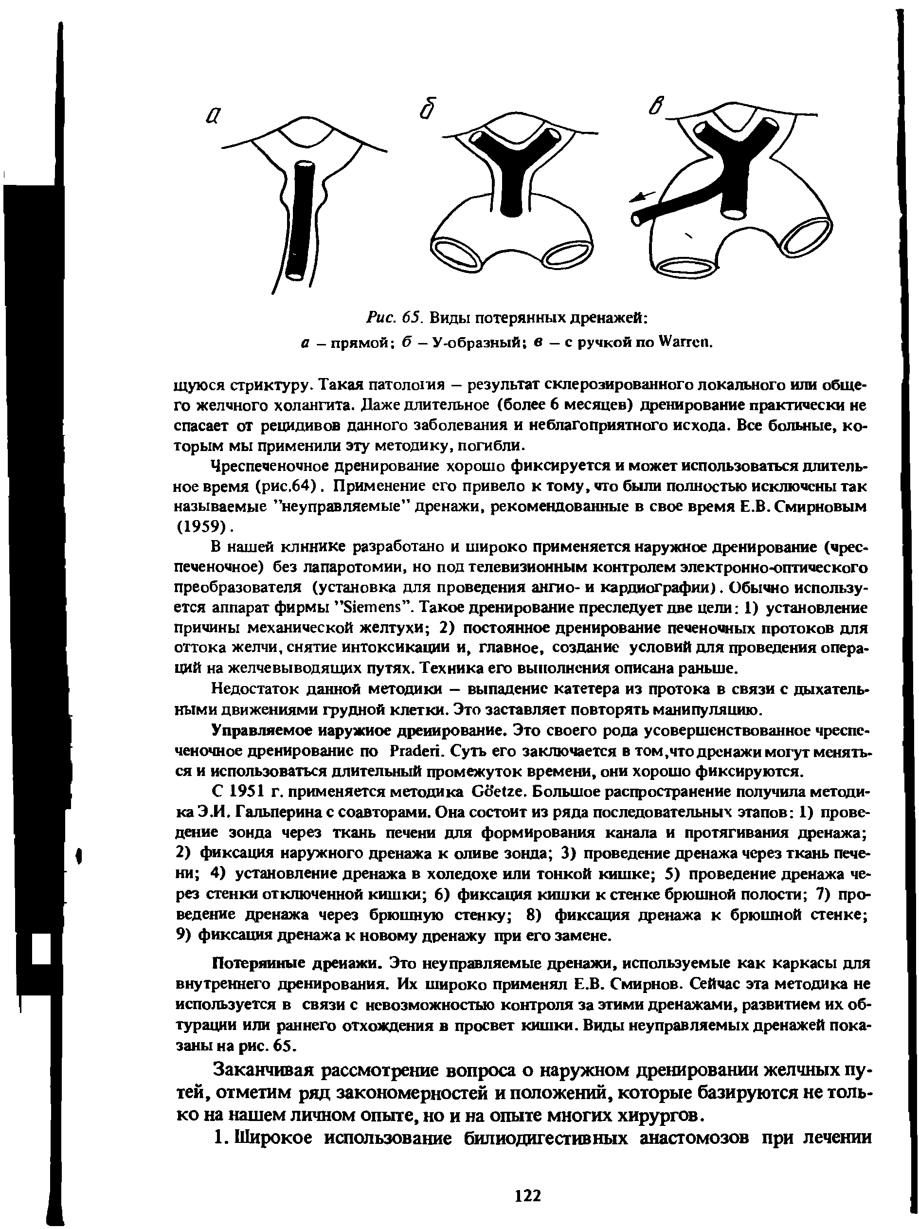 Рис. 65. Виды потерянных дренажей а - прямой б — У-образный в — с ручкой по W .