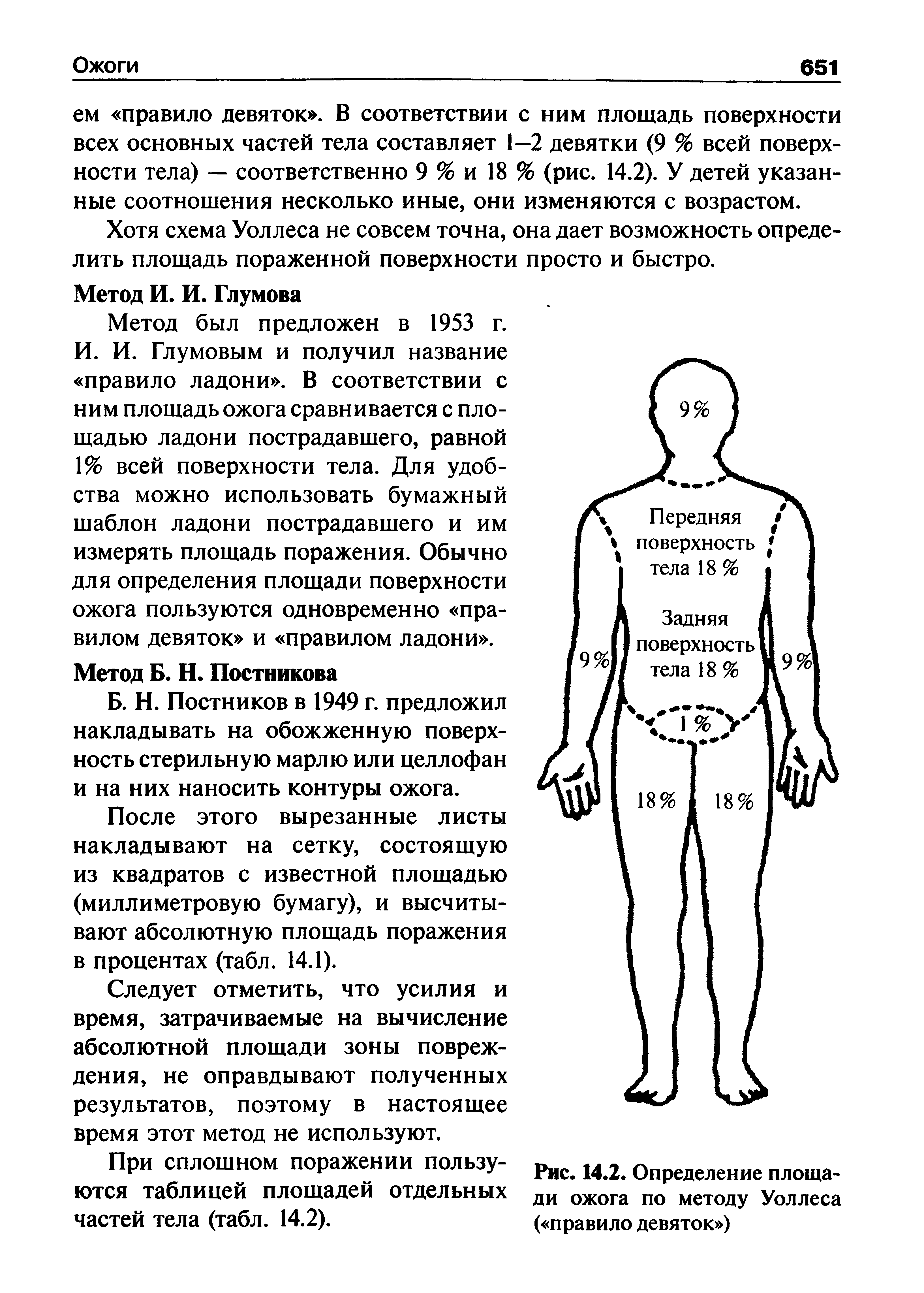 Рис. 14.2. Определение площади ожога по методу Уоллеса ( правило девяток )...