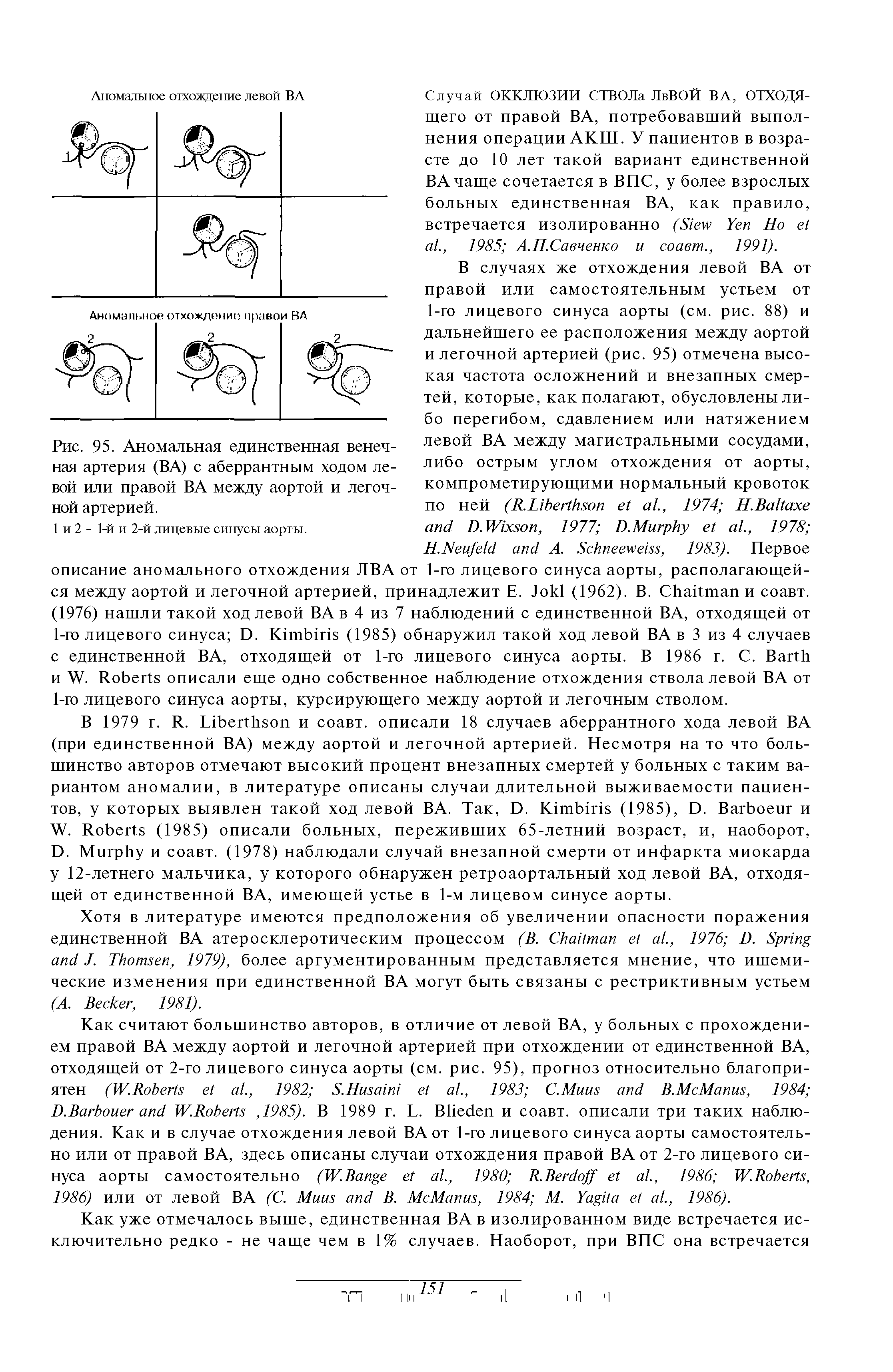 Рис. 95. Аномальная единственная венечная артерия (ВА) с аберрантным ходом левой или правой ВА между аортой и легочной артерией.