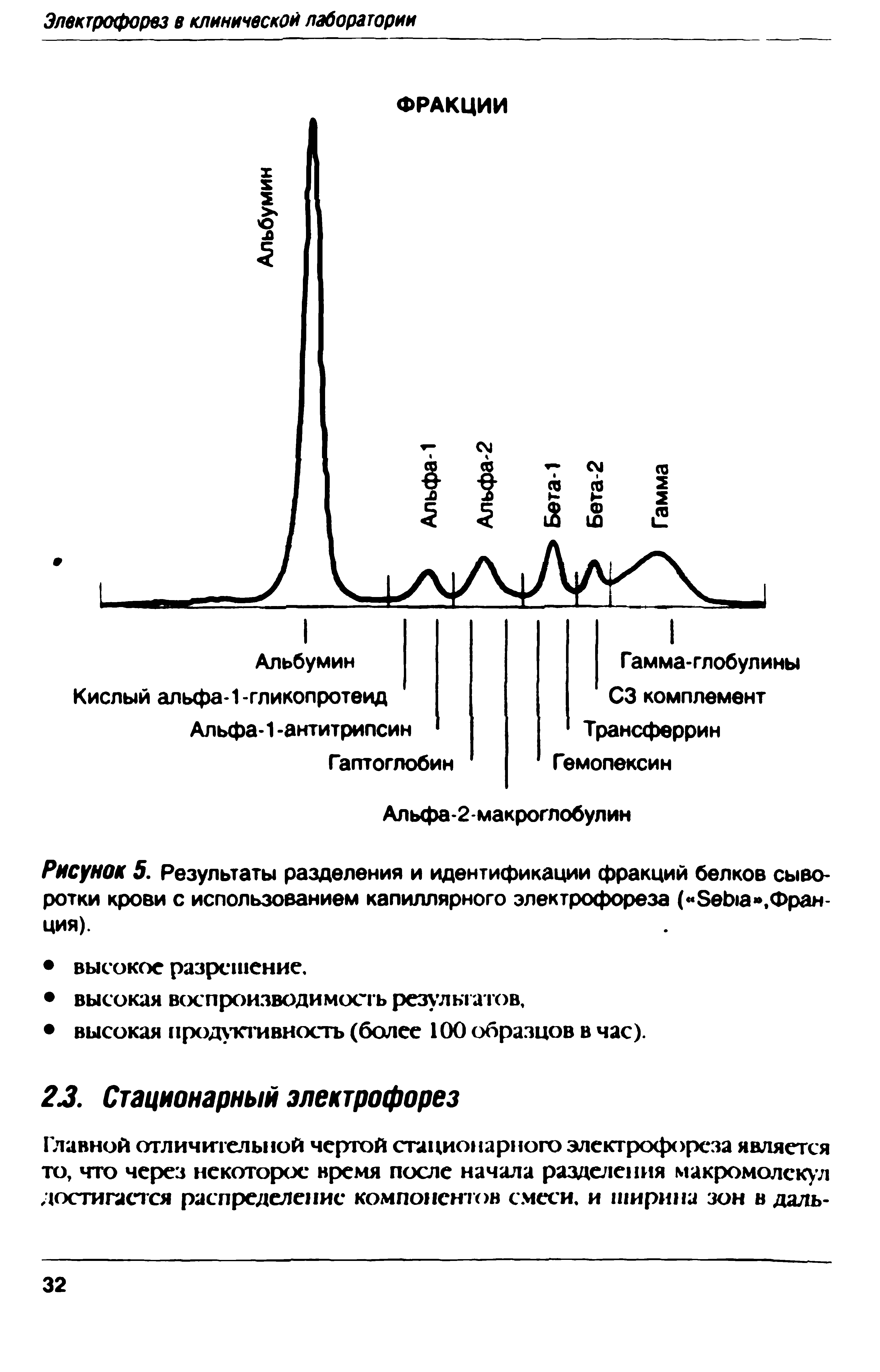 Рисунок 5. Результаты разделения и идентификации фракций белков сыворотки крови с использованием капиллярного электрофореза ( 8еЬ1а ,Франция).