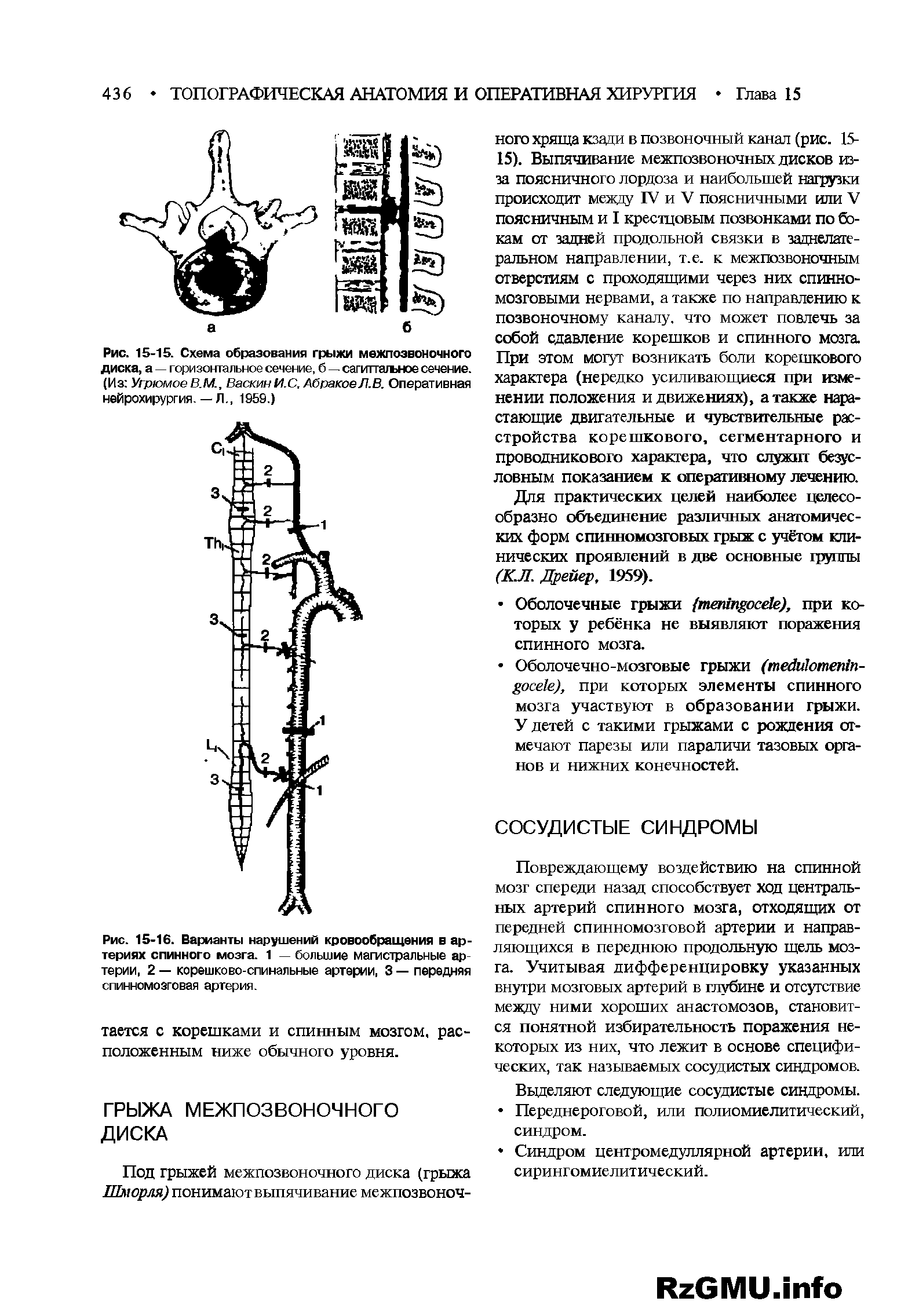 Рис. 15-16. Варианты нарушений кровообращения в артериях спинного мозга. 1 — большие магистральные артерии, 2 — корешково-спинальные артерии, 3 — передняя спинномозговая артерия.