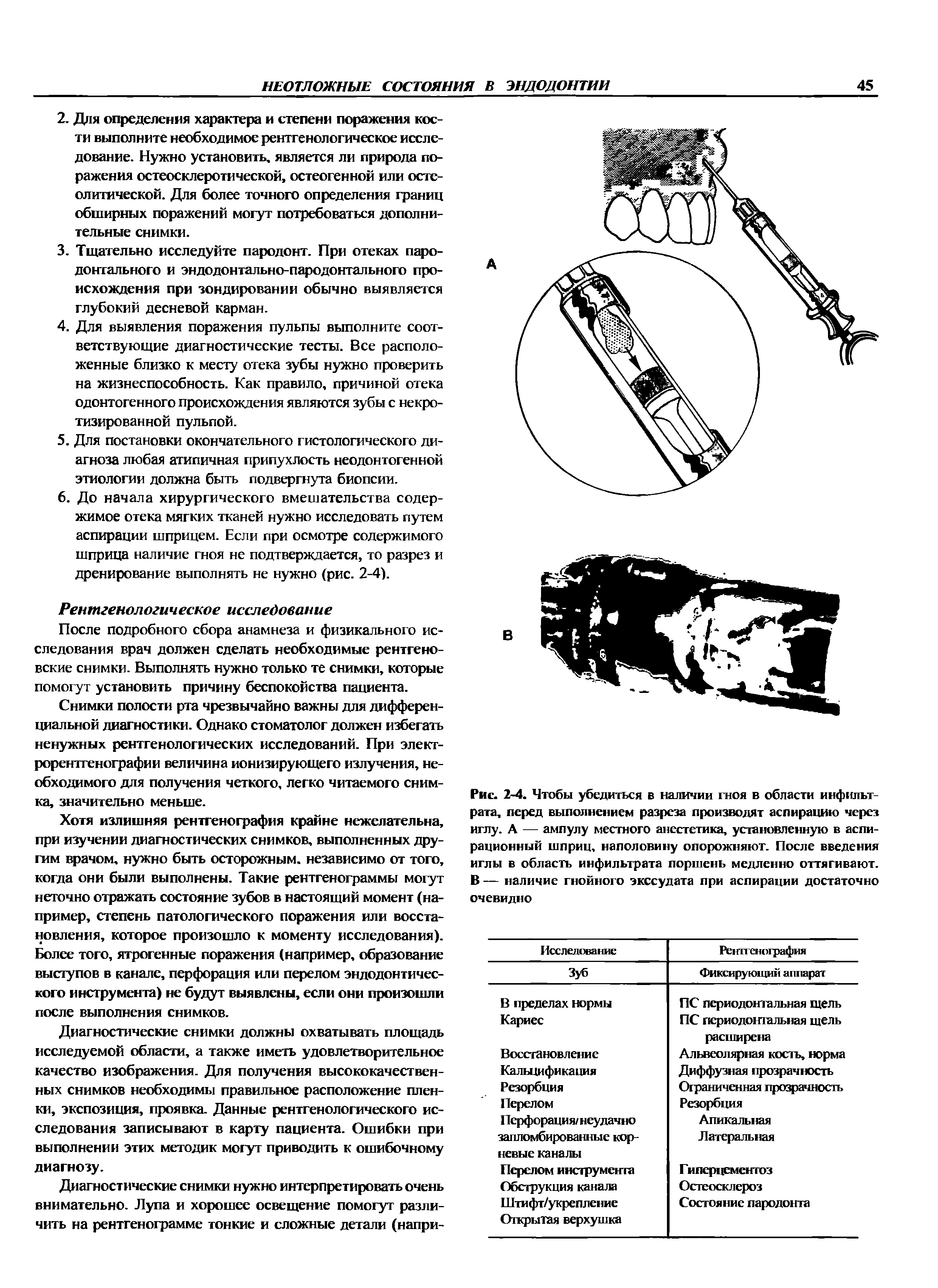 Рис. 2-4. Чтобы убедиться в наличии гноя в области инфильтрата, перед выполнением разреза производят аспирацию через иглу. А — ампулу местного анестетика, установленную в аспирационный шприц, наполовину опорожняют. После введения иглы в область инфильтрата поршень медленно оттягивают. В — наличие гнойного экссудата при аспирации достаточно очевидно...