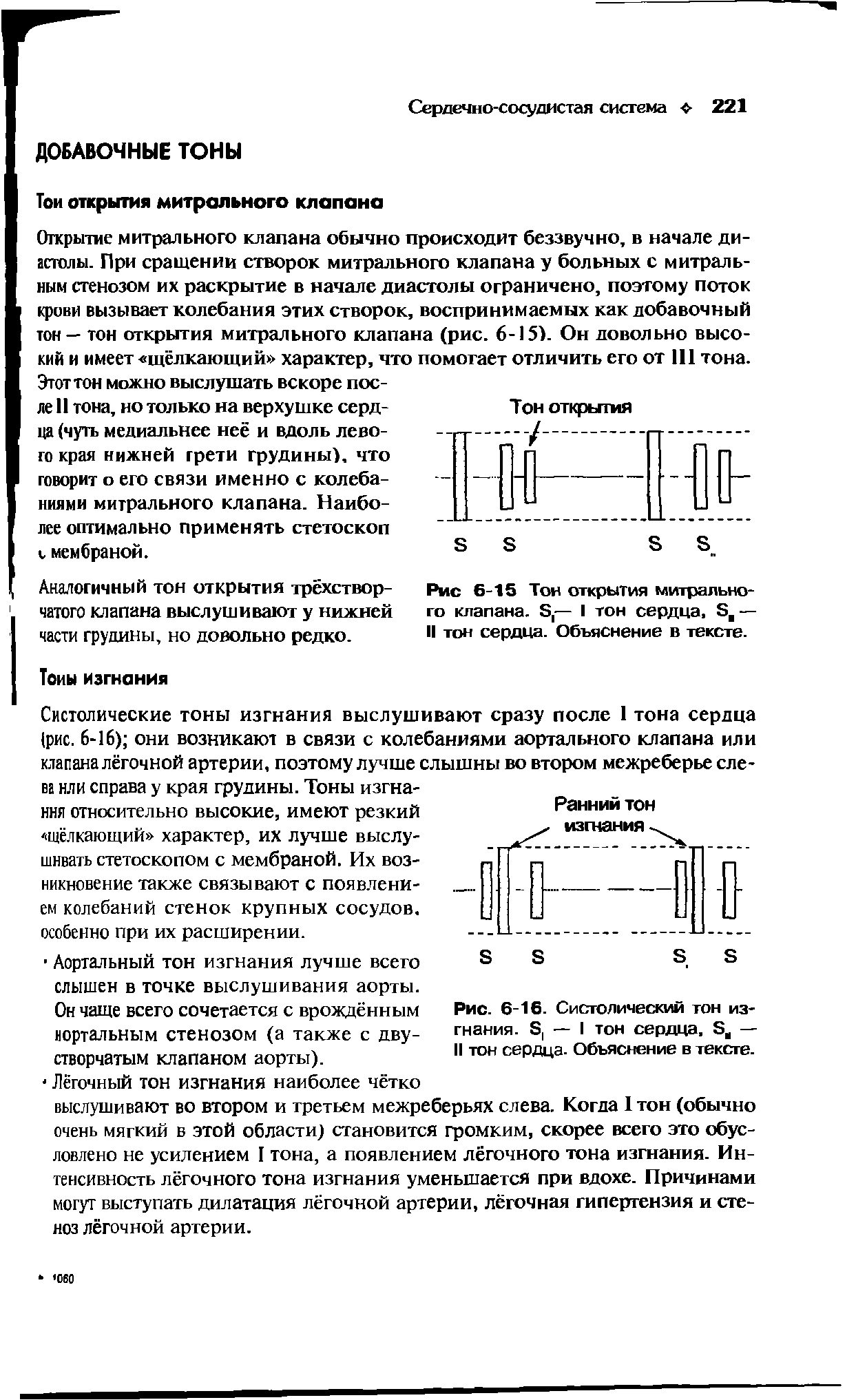 Рис. 6-16. Систолический тон изгнания. Б, — I тон сердца, Эи — II тон сердца. Объяснение в тексте.