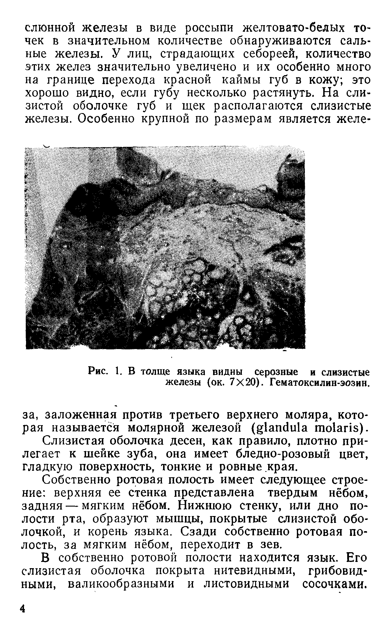 Рис. 1. В толще языка видны серозные и слизистые железы (ок. 7 20). Гематоксилин-эозин.