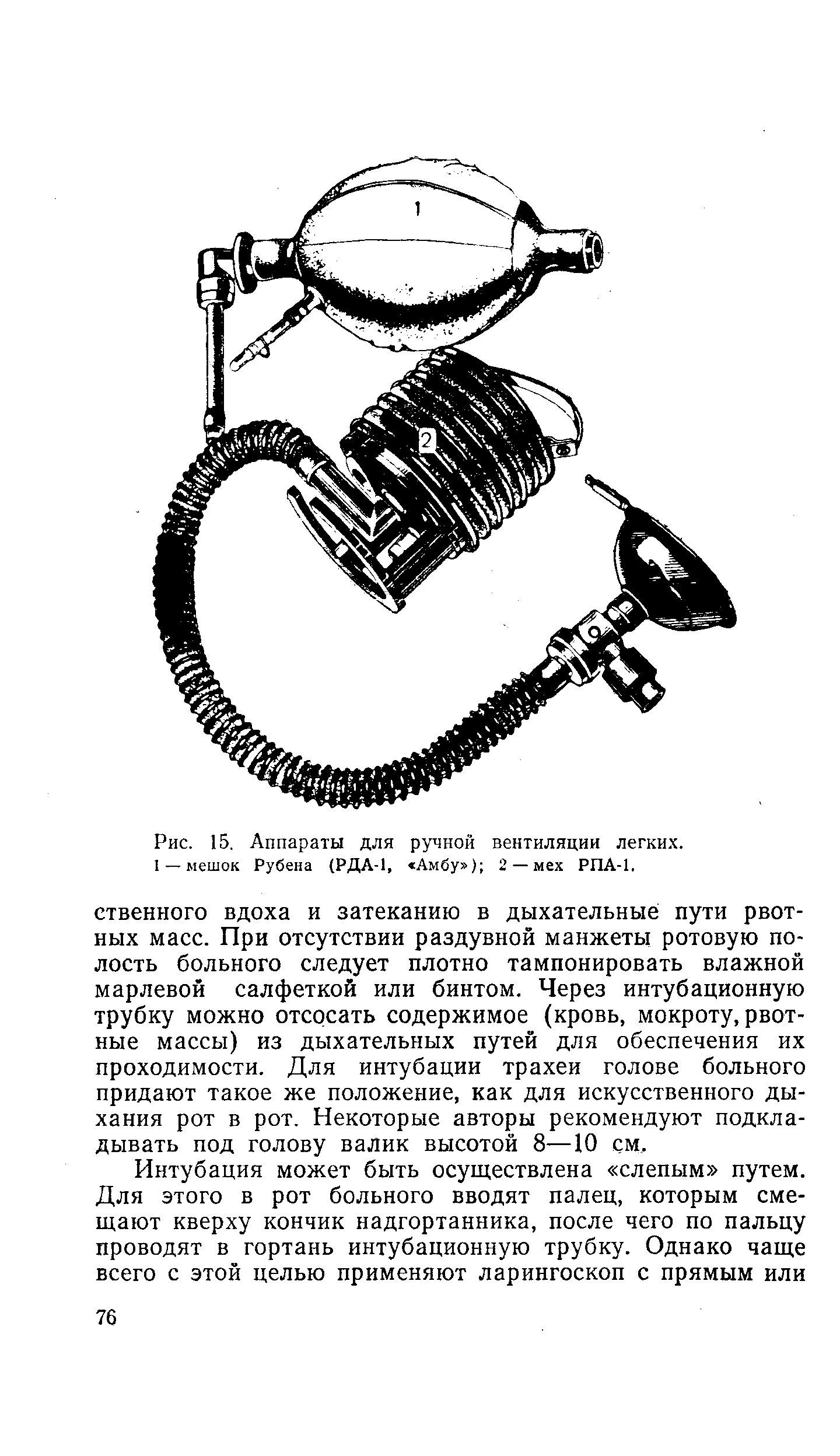 Рис. 15. Аппараты для ручной вентиляции легких. 1 — мешок Рубена (РДА-1, Амбу ) 2 — мех РПА-1.