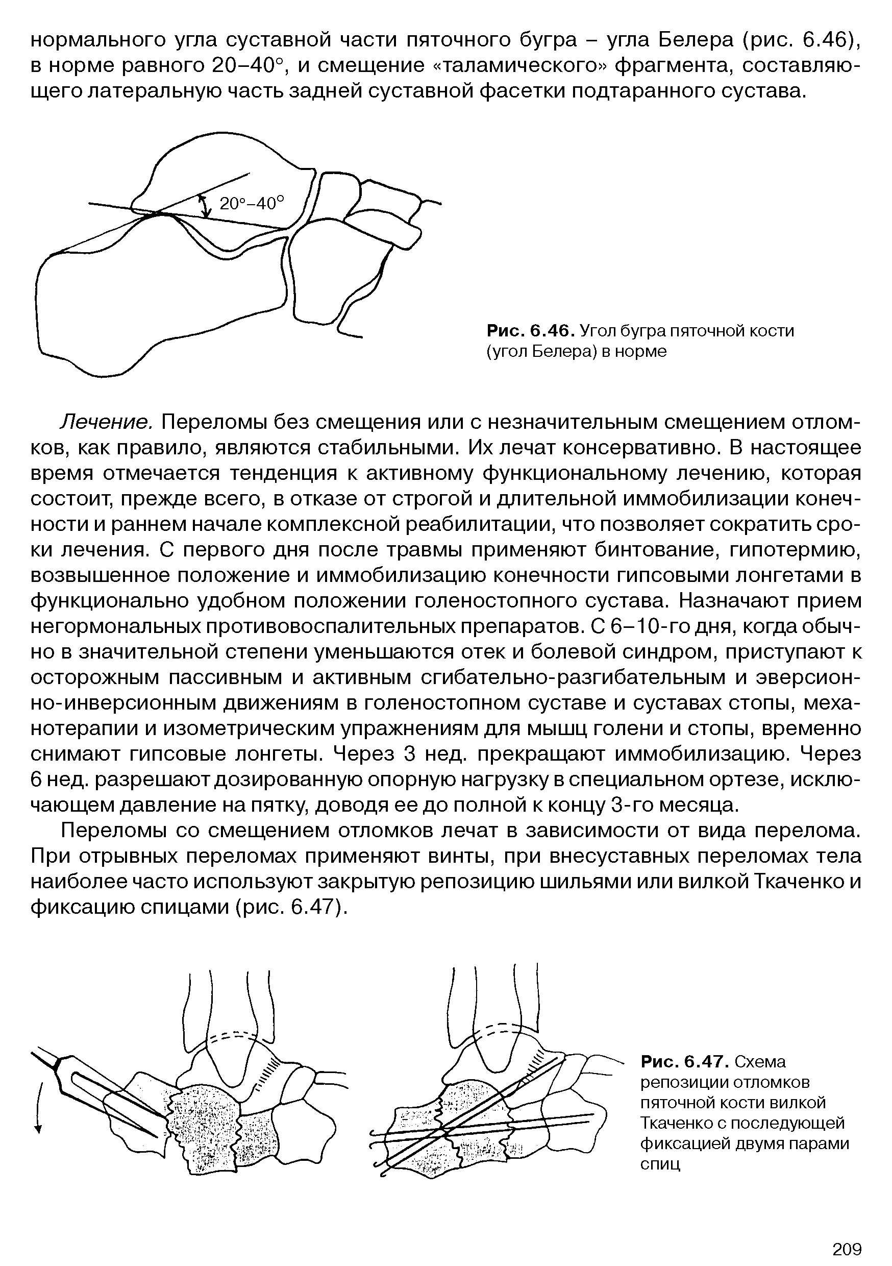 Рис. 6.46. Угол бугра пяточной кости (угол Белера) в норме...