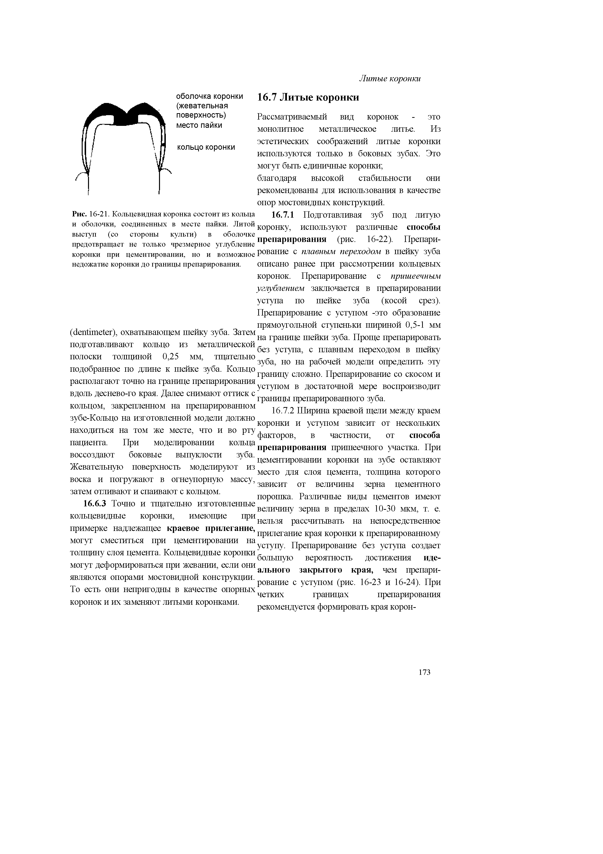 Рис. 16-21. Кольцевидная коронка состоит из кольца и оболочки, соединенных в месте пайки. Литой выступ (со стороны культи) в оболочке предотвращает не только чрезмерное углубление коронки при цементировании, но и возможное недожатие коронки до границы препарирования.