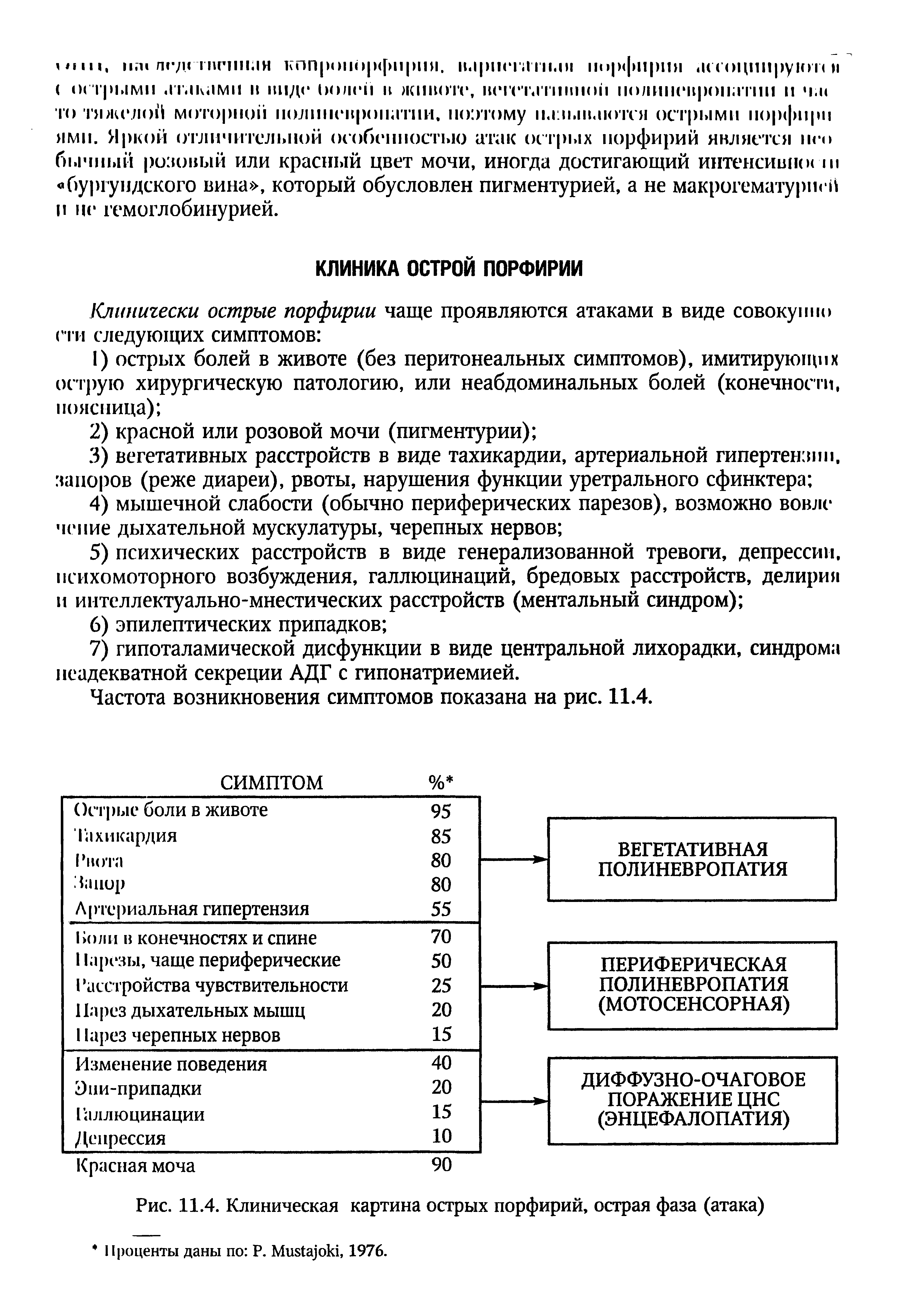 Рис. 11.4. Клиническая картина острых порфирий, острая фаза (атака)...