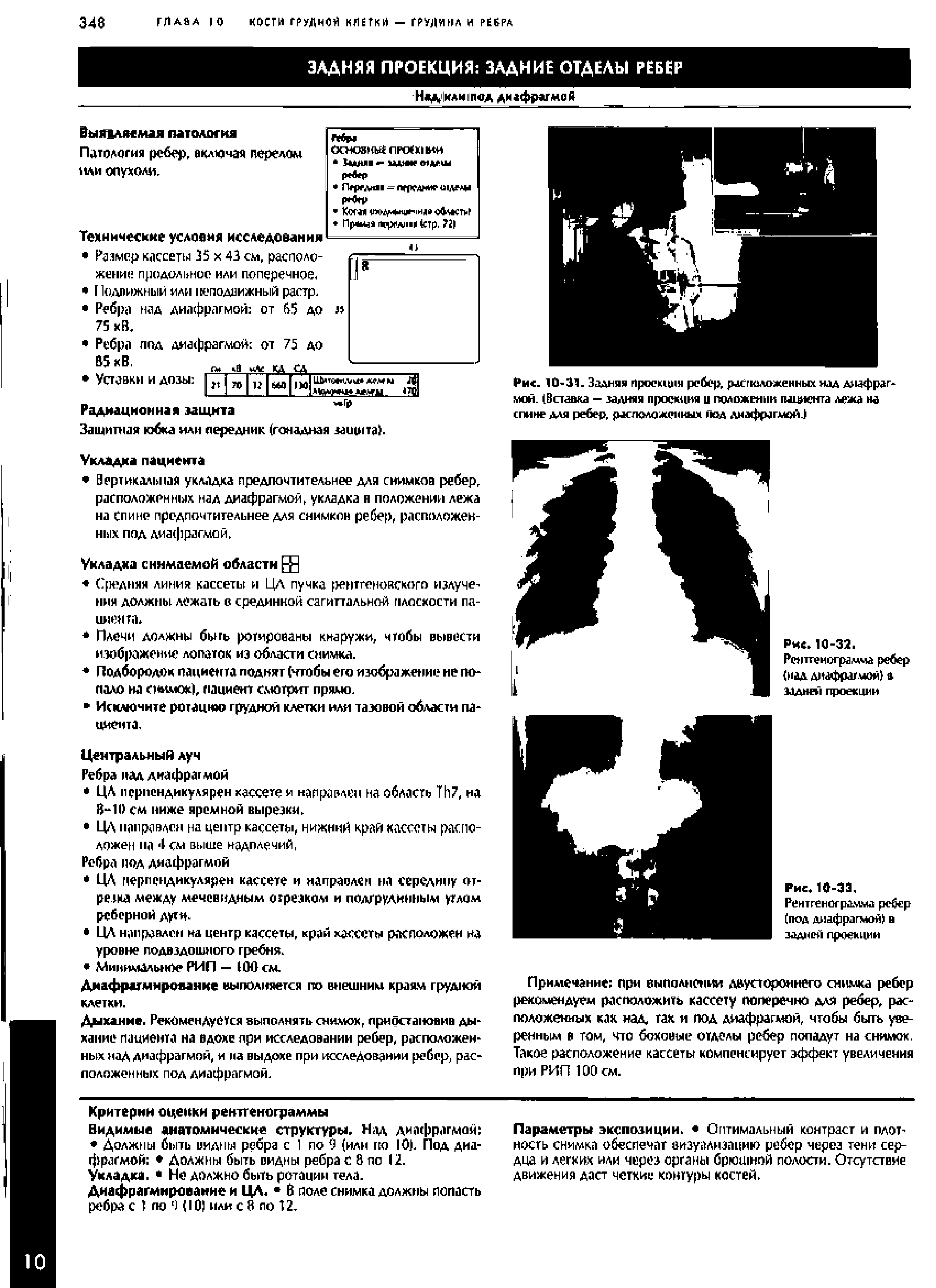 Рис. 10-31. Задняя проекция ребер, расположенных над диафрагмой. (Вставка — задняя проекция и положении пшданта лежа на спине для ребер, расположенных под диафрагмой.)...