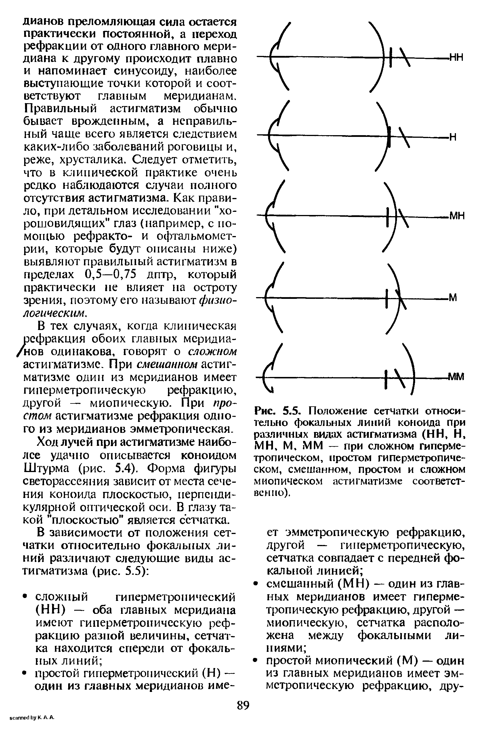 Рис. 5.5. Положение сетчатки относительно фокальных линий коноида при различных видах астигматизма (НН, Н, МН, М. ММ — при сложном гиперметропическом, простом гиперметропическом, смешанном, простом и сложном. миопическом астигматизме соответственно).