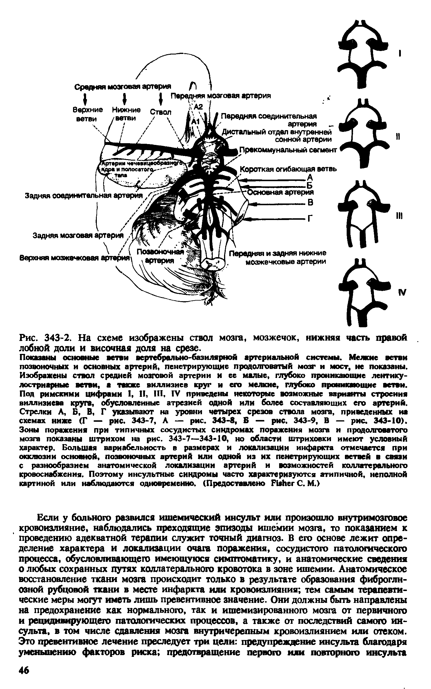 Рис. 343-2. На схеме изображены ствол мозга, мозжечок, нижняя часть правой лобной доли и височная доля на срезе.