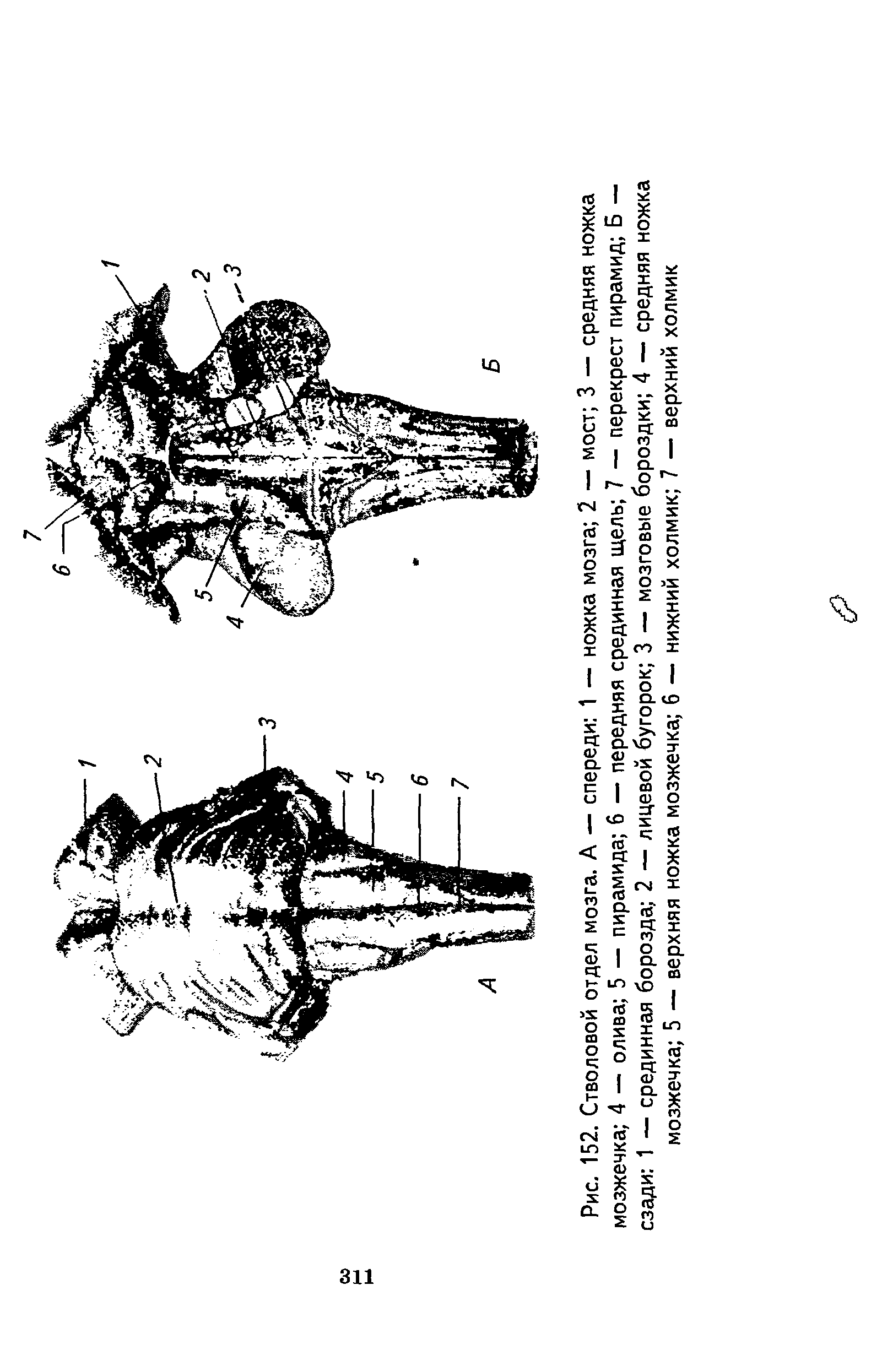 Рис. 152. Стволовой отдел мозга. А — спереди 1 — ножка мозга 2 — мост 3 — средняя ножка мозжечка 4 — олива 5 — пирамида 6 — передняя срединная щель 7 — перекрест пирамид Б — сзади 1 — срединная борозда 2 — лицевой бугорок 3 — мозговые бороздки 4 — средняя ножка мозжечка 5 — верхняя ножка мозжечка 6 — нижний холмик 7 — верхний холмик...