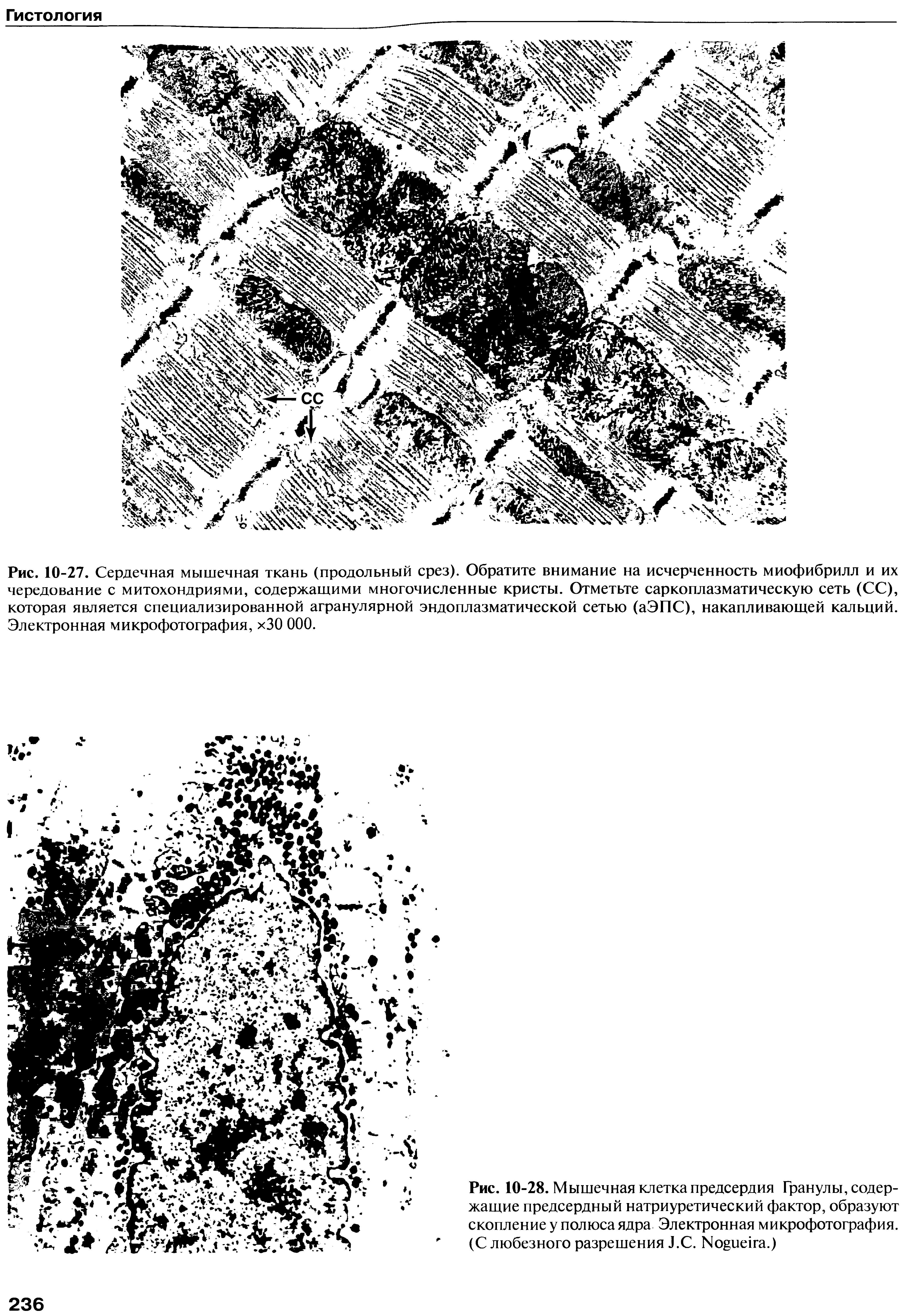 Рис. 10-28. Мышечная клетка предсердия Гранулы, содержащие предсердный натриуретический фактор, образуют скопление у полюса ядра Электронная микрофотография. (С любезного разрешения J.C. N .)...