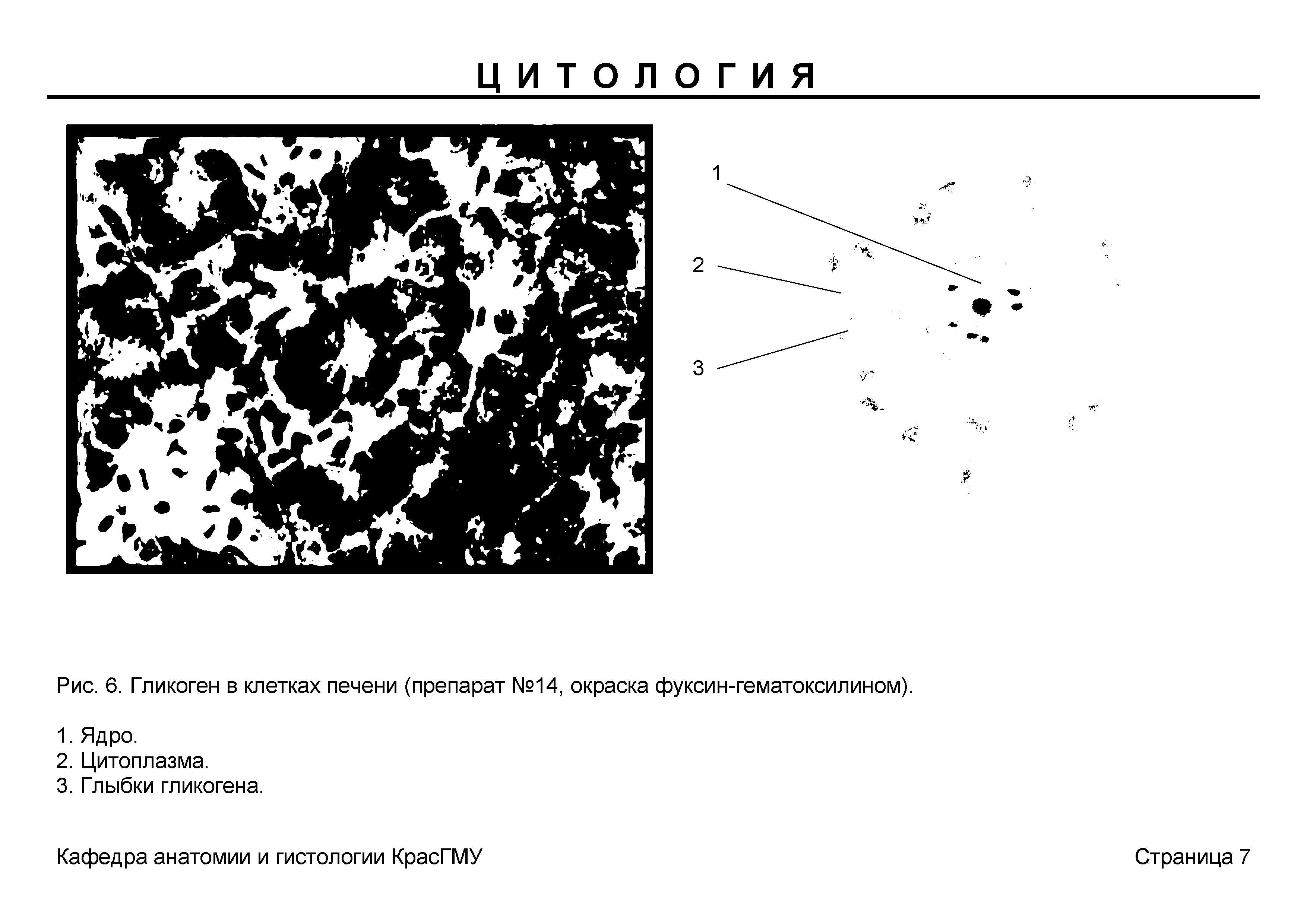 Рис. 6. Гликоген в клетках печени (препарат №14, окраска фуксин-гематоксилином).