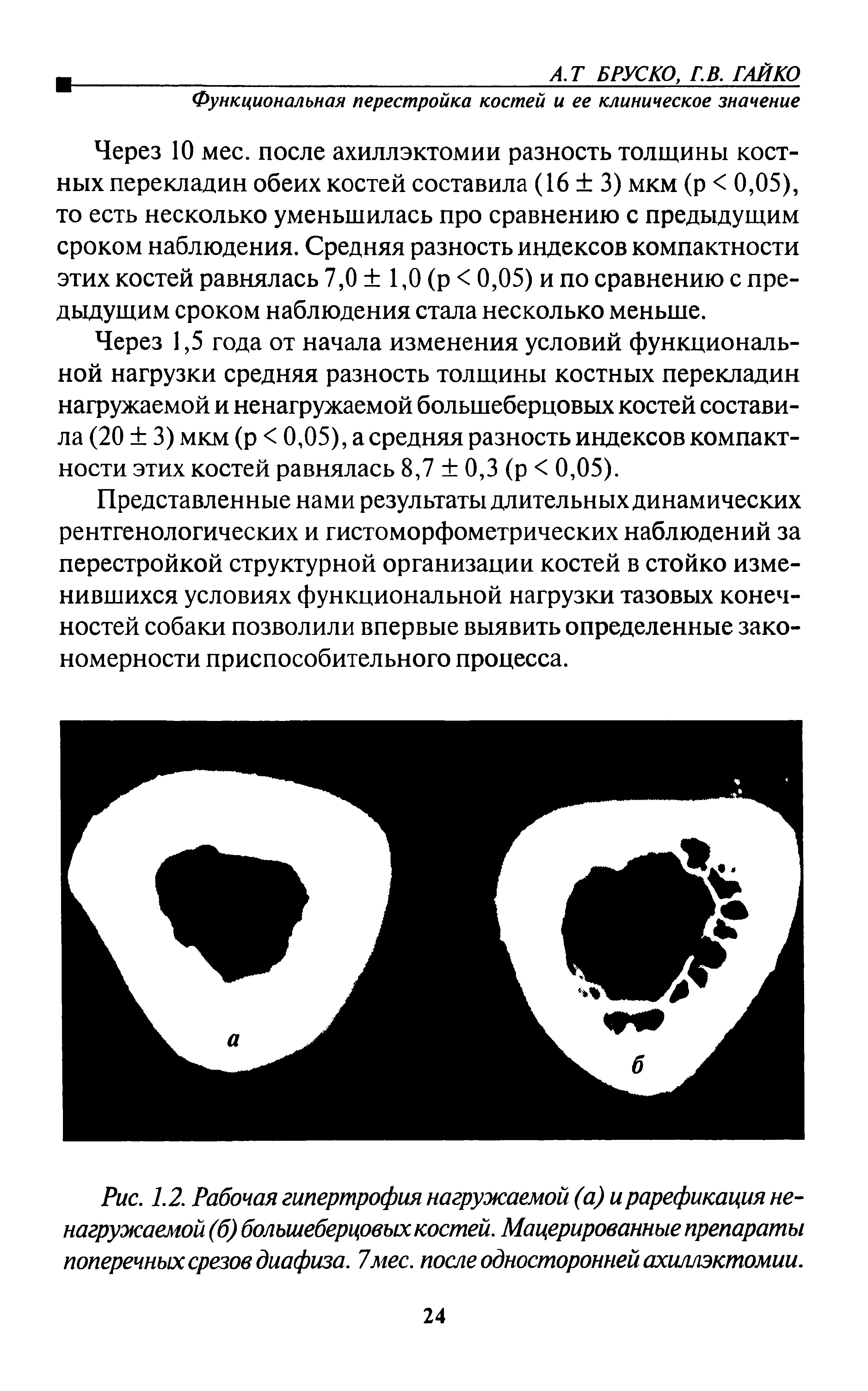 Рис. 1.2. Рабочая гипертрофия нагружаемой (а) и рарефикация ненагружаемой (б) большеберцовых костей. Мацерированные препараты поперечных срезов диафиза. 7мес. после односторонней ахиллэктомии.