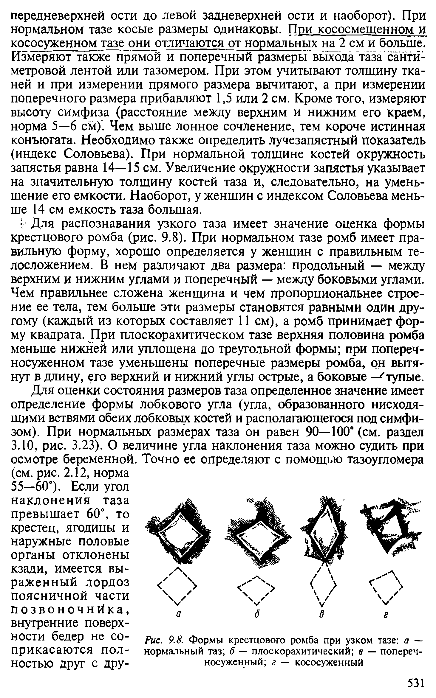 Рис. 9.8. Формы нормальный таз б — плоскорахитический в — попереч-носуженный г — кососуженный...