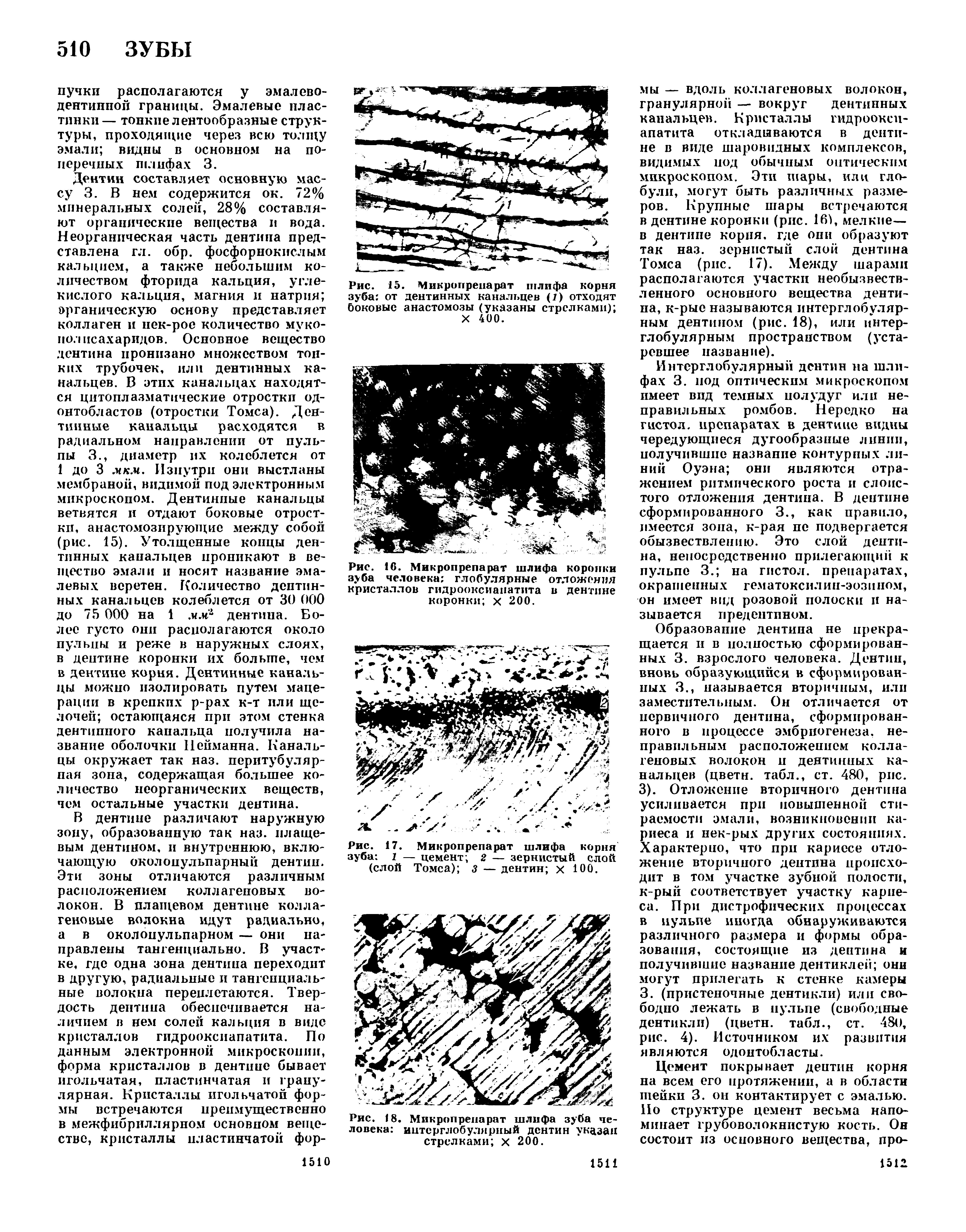 Рис. 17. Микропрепарат шлифа корня зуба 1 — цемент 2 — зернистый слой (слой Томса) з — дентин х 100.