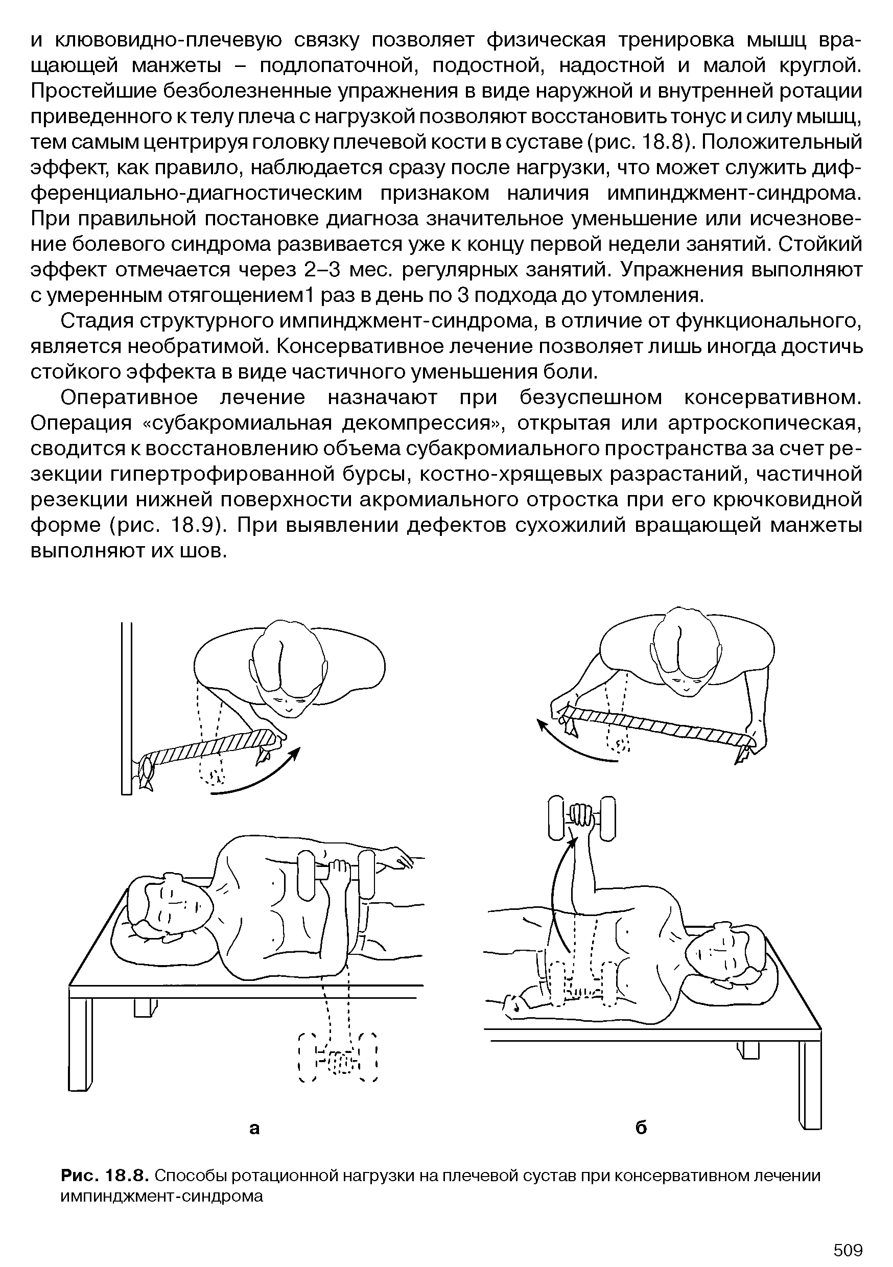 Рис. 18.8. Способы ротационной нагрузки на плечевой сустав при консервативном лечении импинджмент-синдрома...