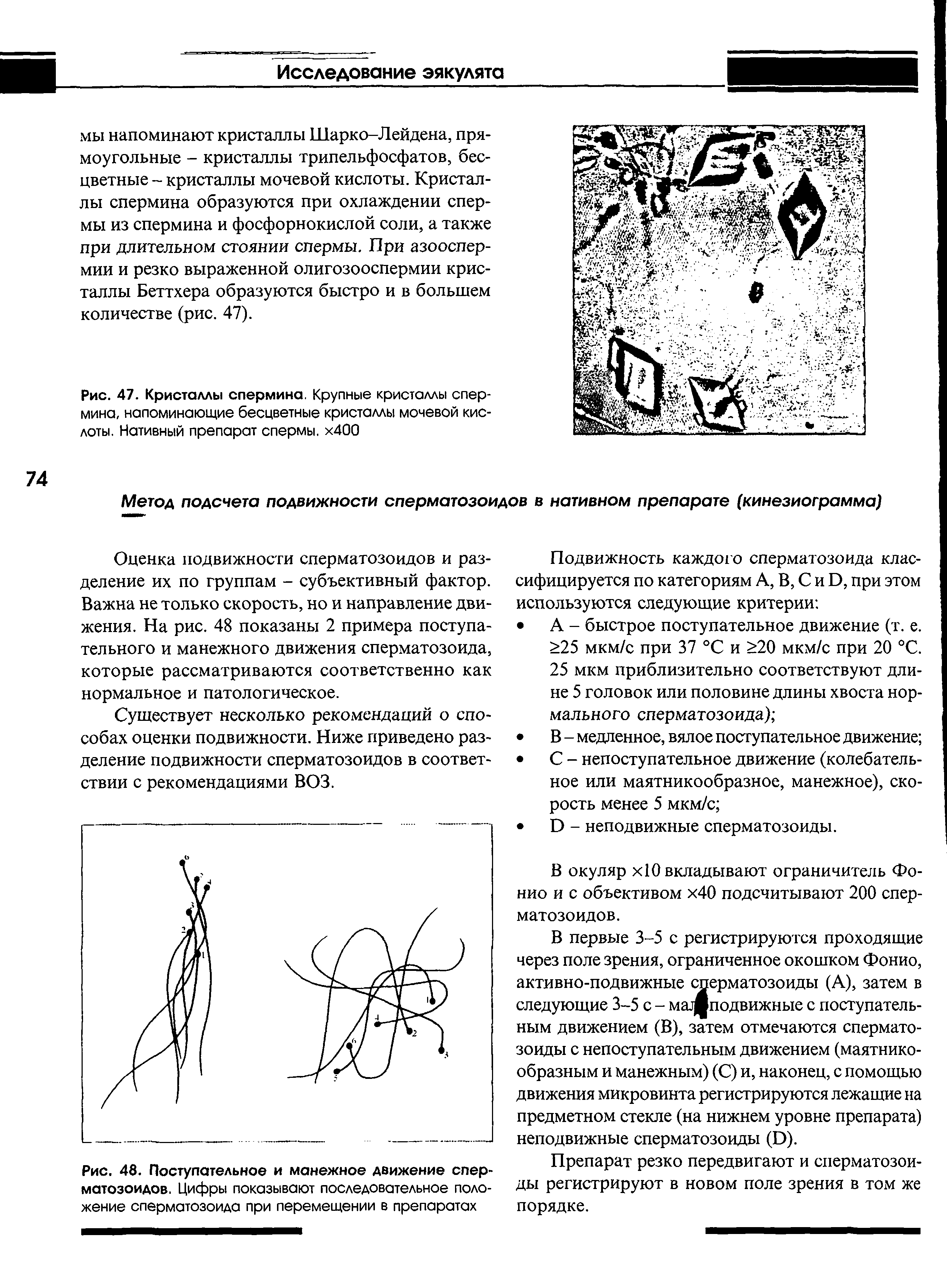 Рис. 47. Кристаллы спермина. Крупные кристаллы спермина, напоминающие бесцветные кристаллы мочевой кислоты. Нативный препарат спермы. х400...