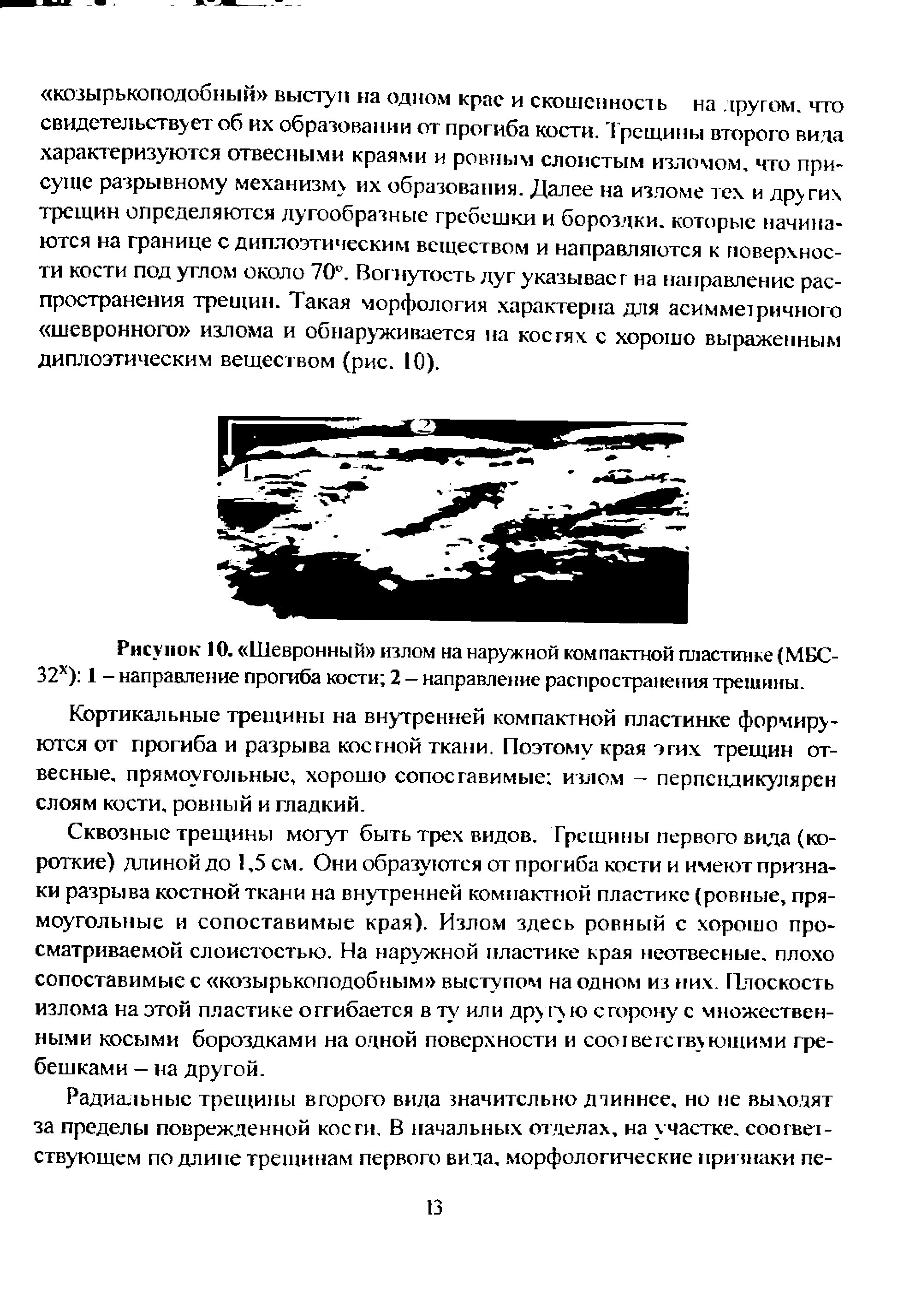 Рисунок 10. Шевронный излом на наружной компактной пластинке (МБС-32х) 1 - направление прогиба кости 2 - направление распространения трешнны.