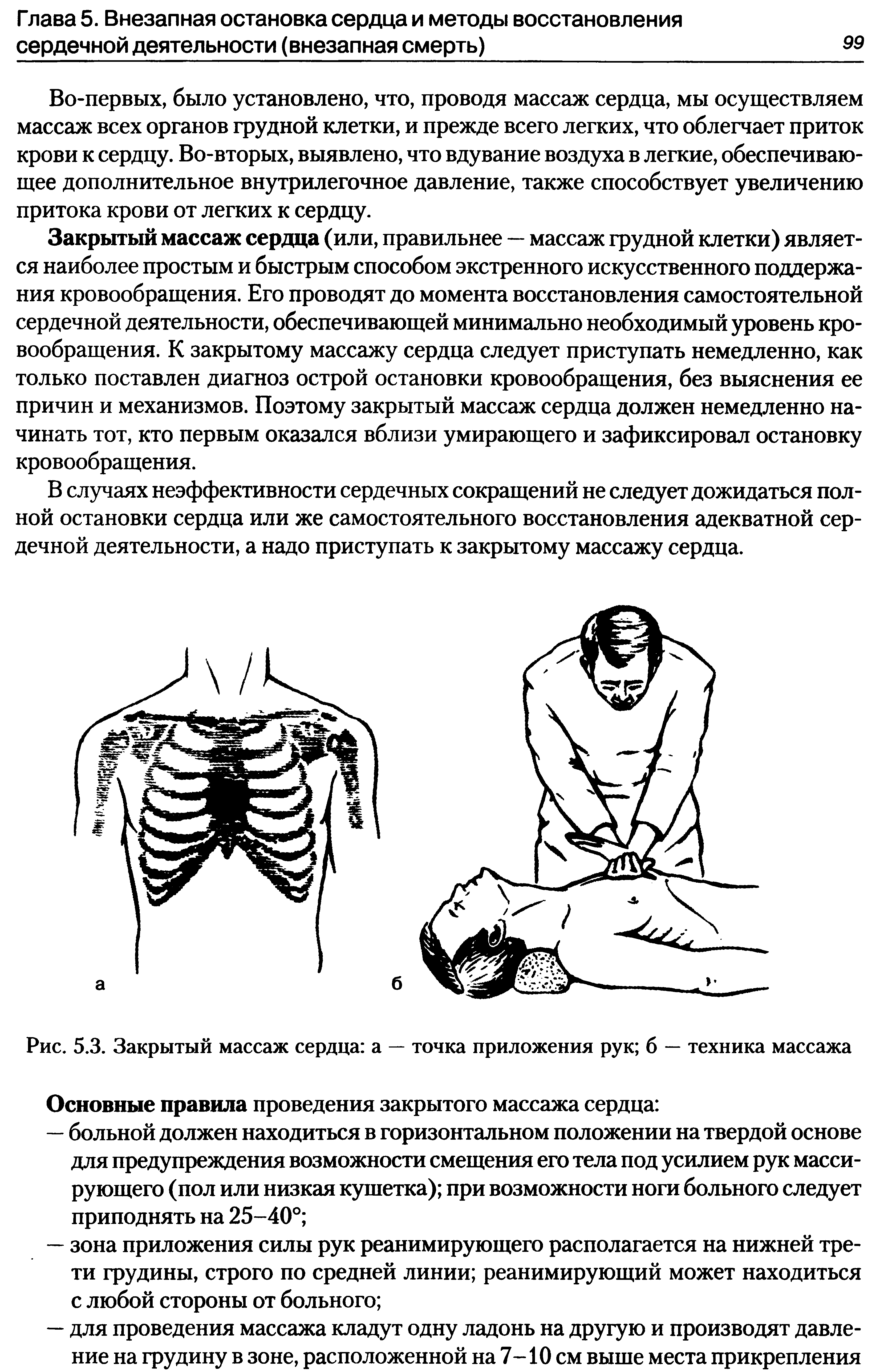 Рис. 5.3. Закрытый массаж сердца а — точка приложения рук б — техника массажа...