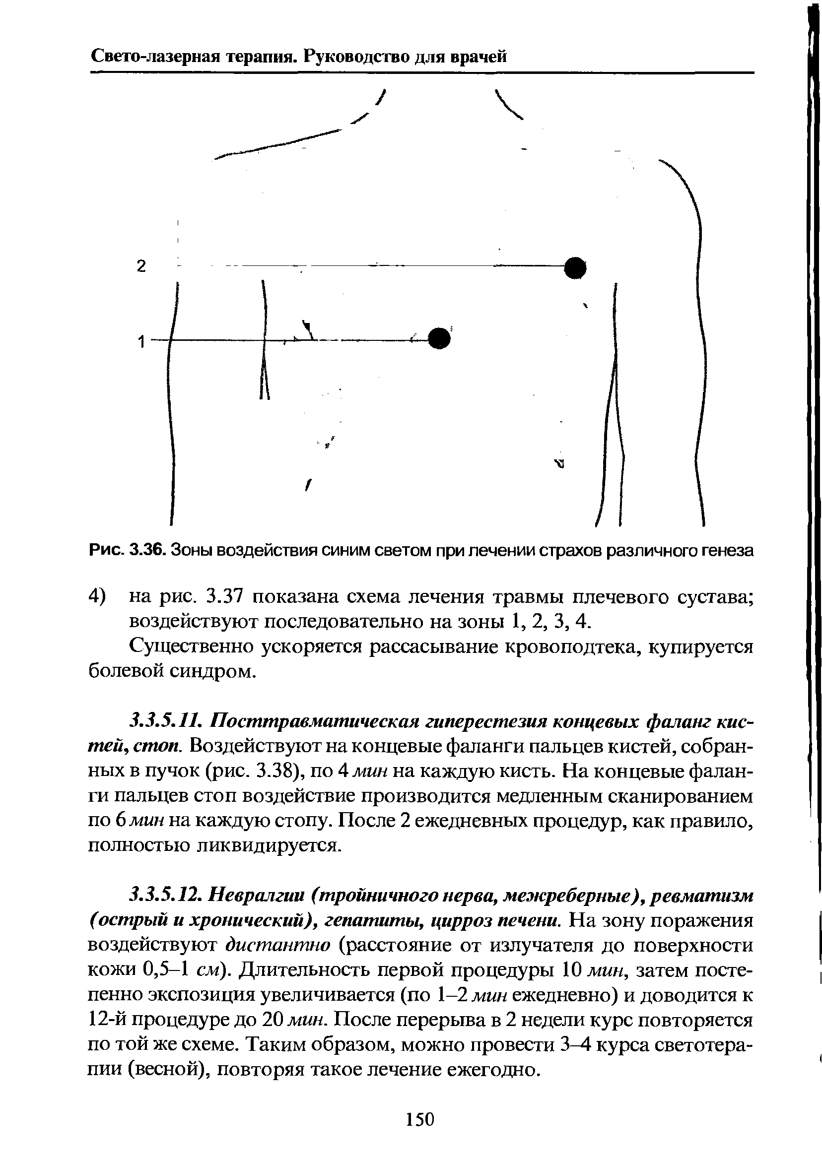 Рис. 3.36. Зоны воздействия синим светом при лечении страхов различного генеза...