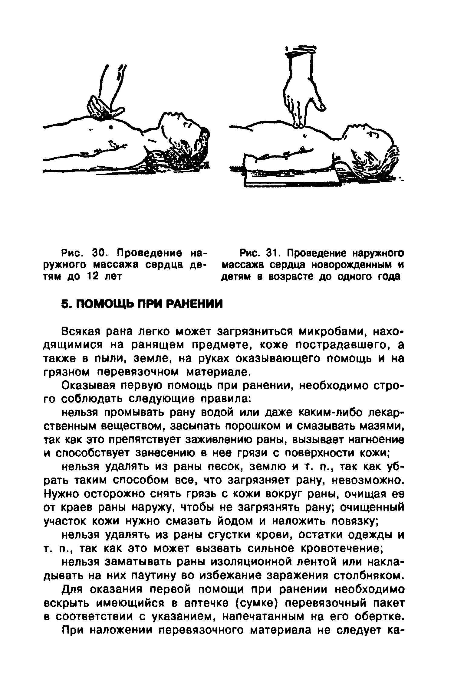 Рис. 31. Проведение наружного массажа сердца новорожденным и детям в возрасте до одного года...