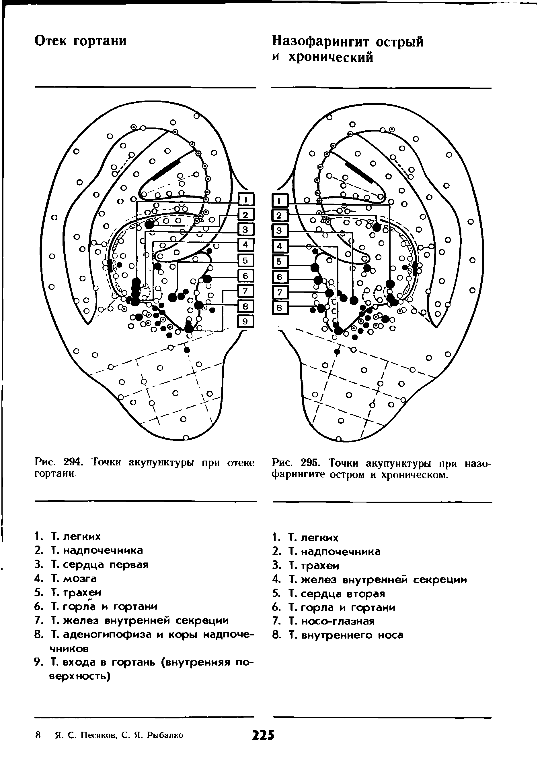 Рис. 295. Точки акупунктуры при назо-фарингите остром и хроническом.