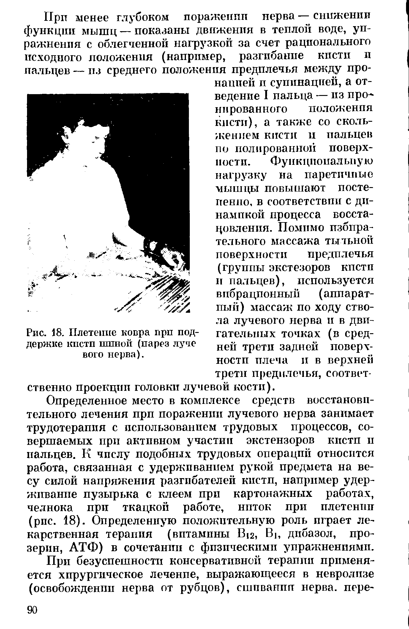 Рис. 18. Плетение ковра прп поддержке кпстп шпной (парез луче вого нерва).