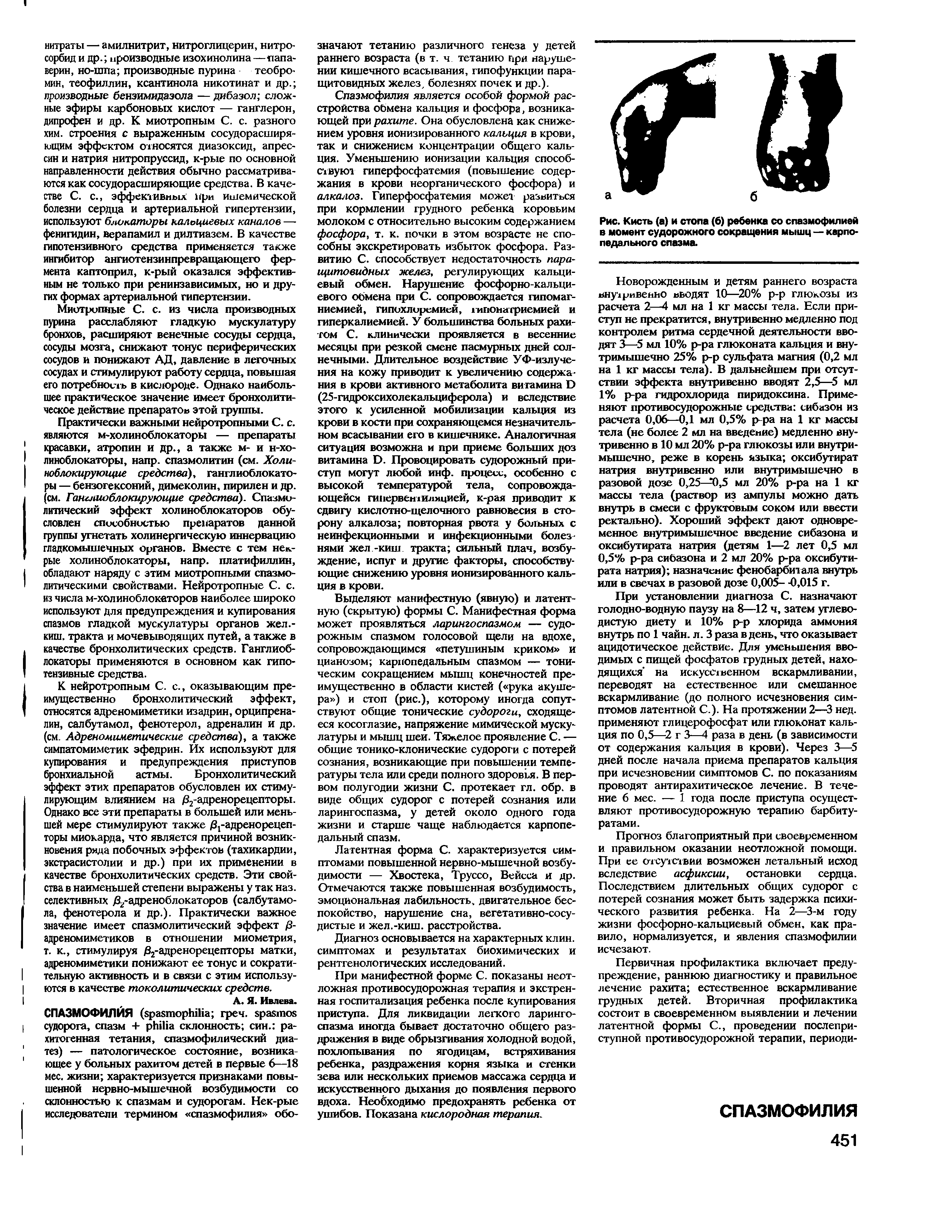 Рис. Кисть (а) и стопа (6) ребенка со спазмофилией в момент судорожного сокращения мышц — карпопедального спазма.