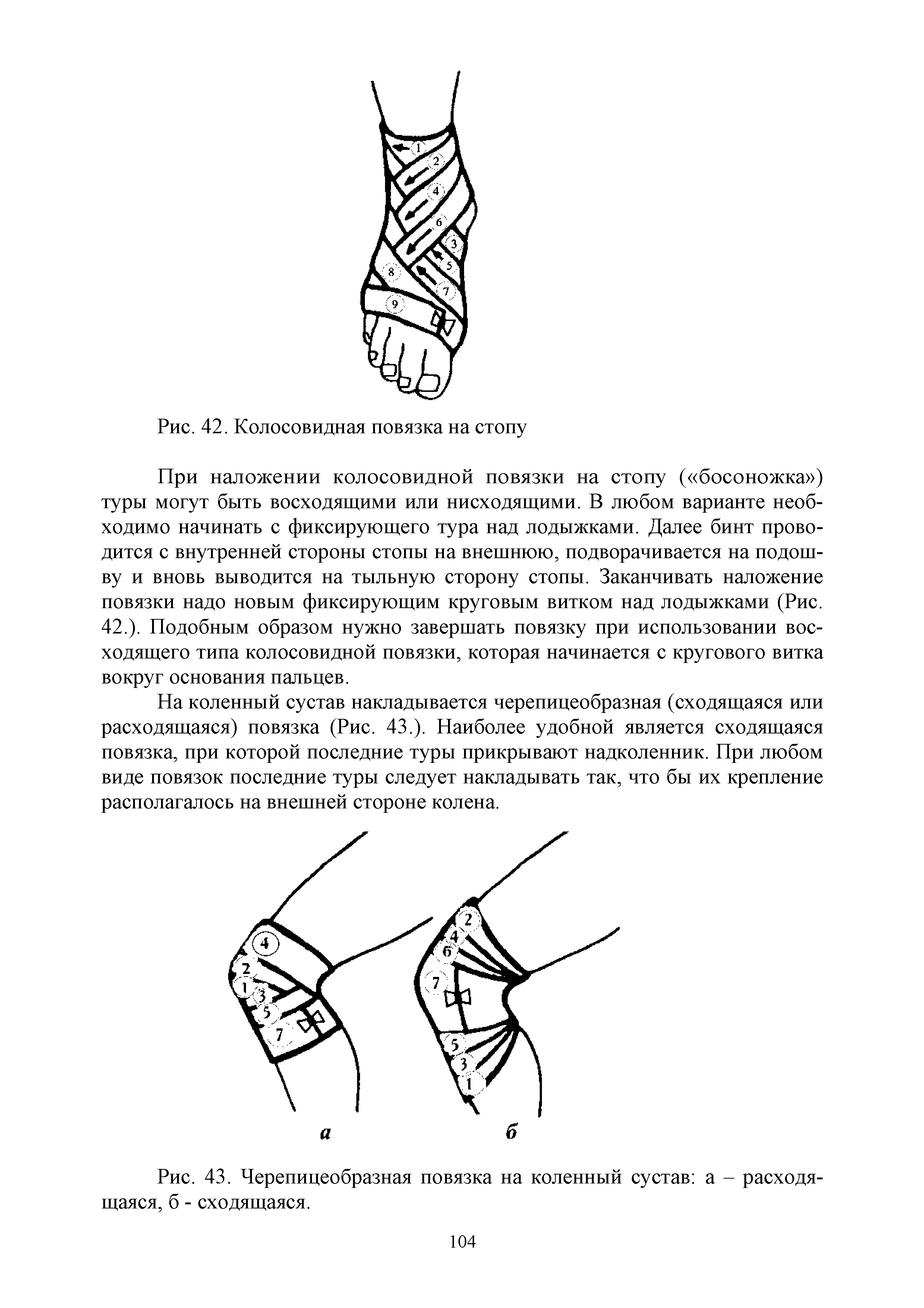 Рис. 43. Черепицеобразная повязка на коленный сустав а - расходящаяся, б - сходящаяся.