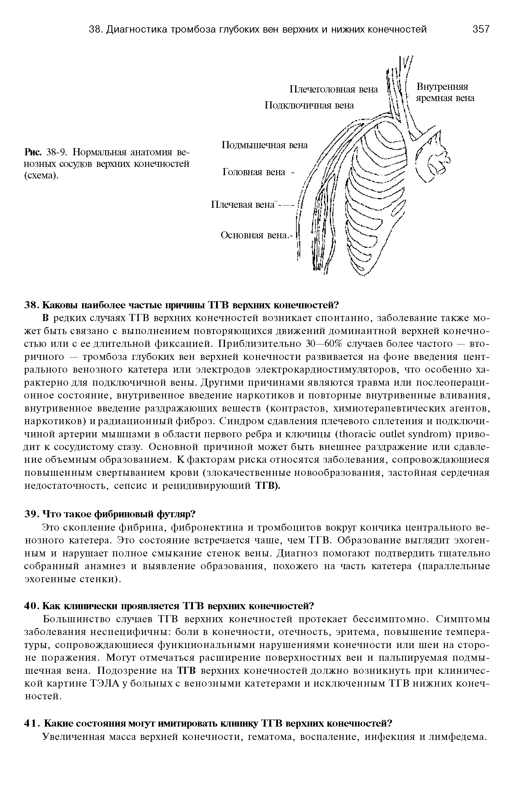 Рис. 38-9. Нормальная анатомия венозных сосудов верхних конечностей (схема).