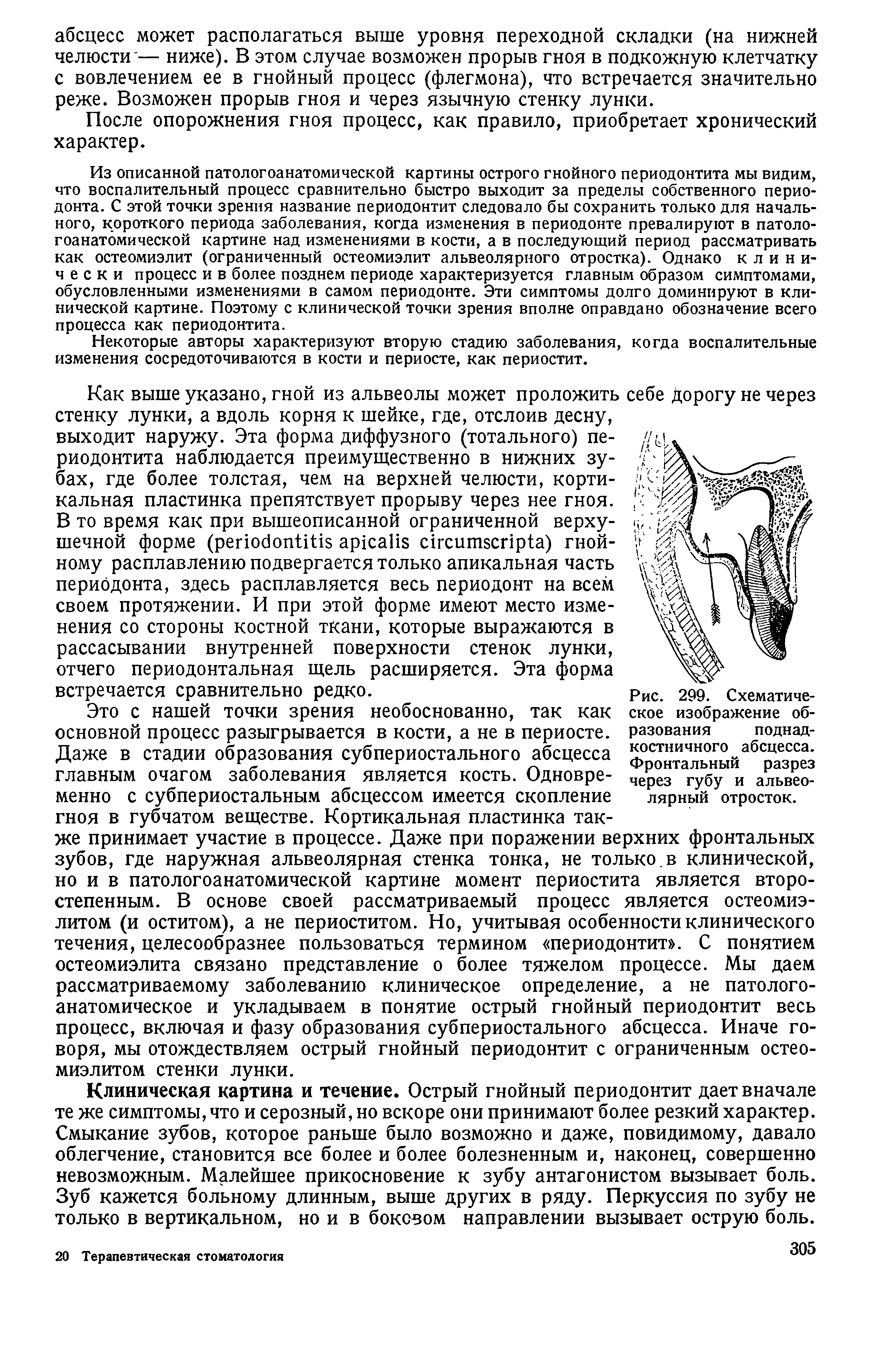 Рис. 299. Схематическое изображение образования поднадкостничного абсцесса. Фронтальный разрез через губу и альвеолярный отросток.