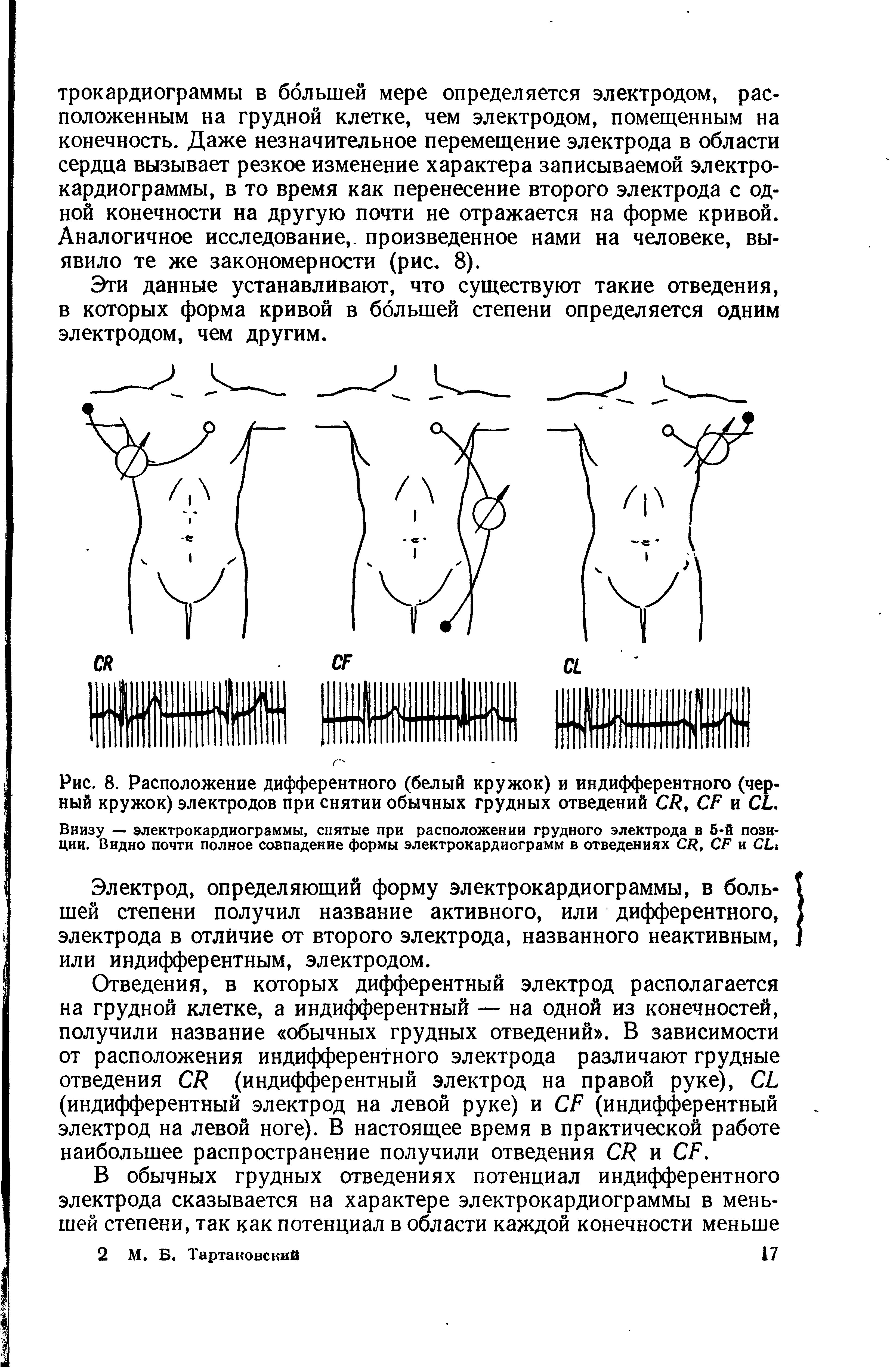 Рис. 8. Расположение дифферентного (белый кружок) и индифферентного (черный кружок) электродов при снятии обычных грудных отведений СТ , С/7 и СЬ. Внизу — электрокардиограммы, снятые при расположении грудного электрода в 5-й позиции. Видно почти полное совпадение формы электрокардиограмм в отведениях СК, СР и СЬ ...