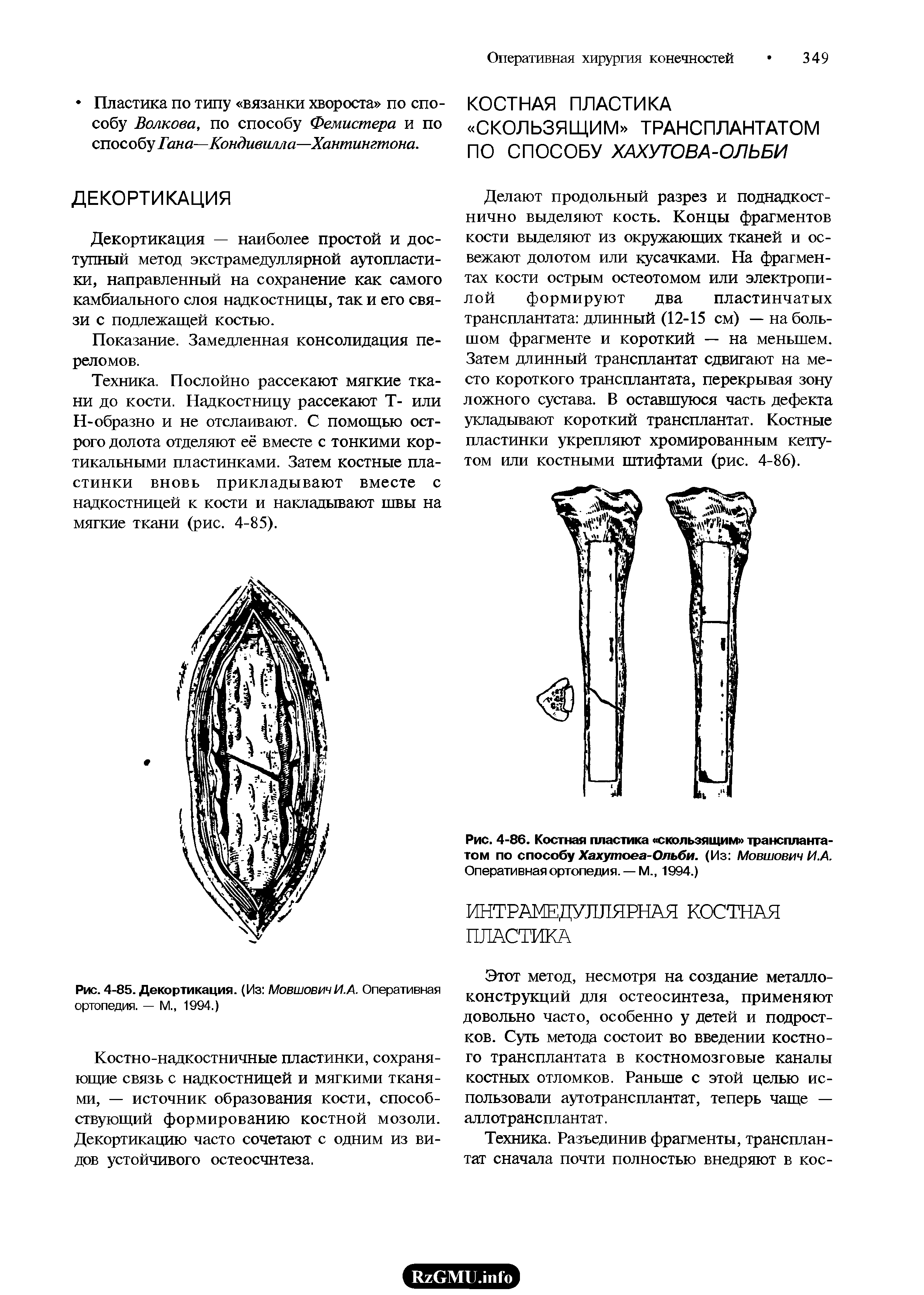 Рис. 4-86. Костная пластика скользящим трансплантатом по способу Хахутоеа-Ольби. (Из Мовшович И.А. Оперативная ортопедия. —М., 1994.)...