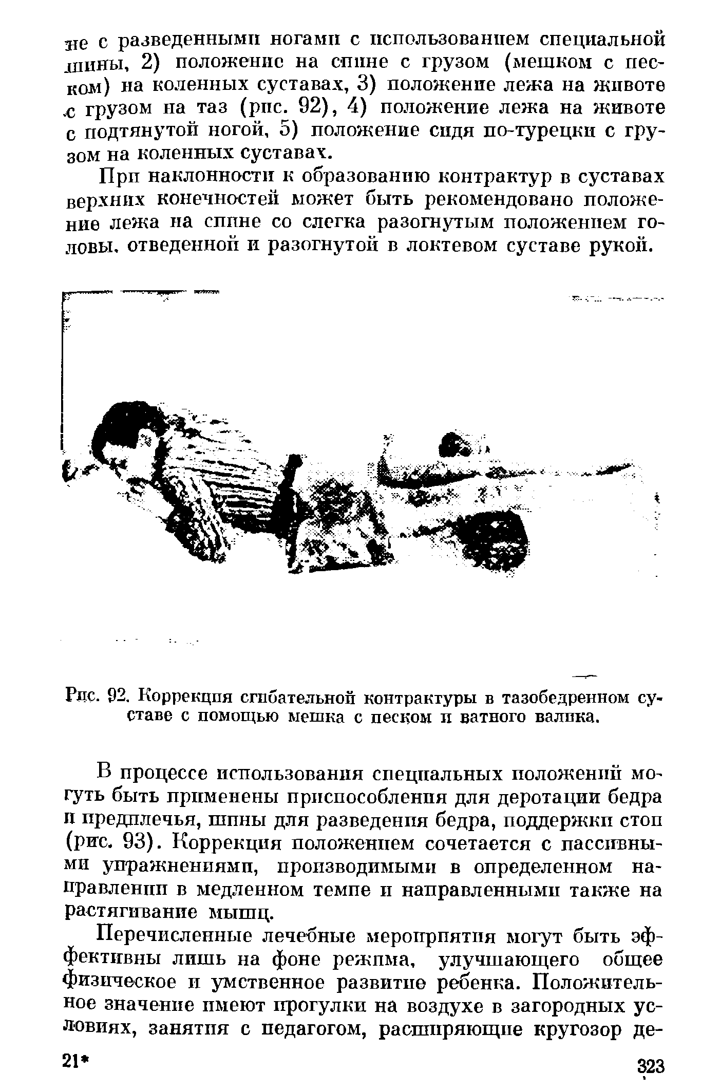 Рис. 92. Коррекция сгибательной контрактуры в тазобедренном суставе с помощью мешка с песком и ватного валика.