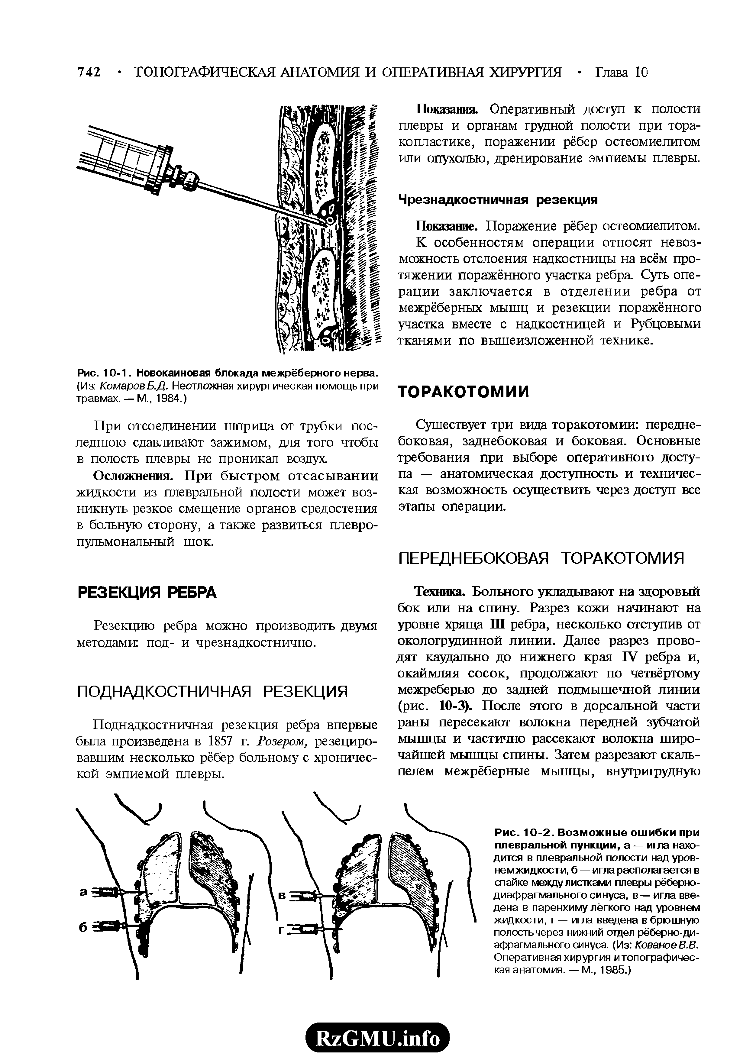 Рис. 10-1. Новокаиновая блокада межрёберного нерва. (Из КомаровБ.Д. Неотложная хирургическая помощь при травмах. — М., 1984.)...