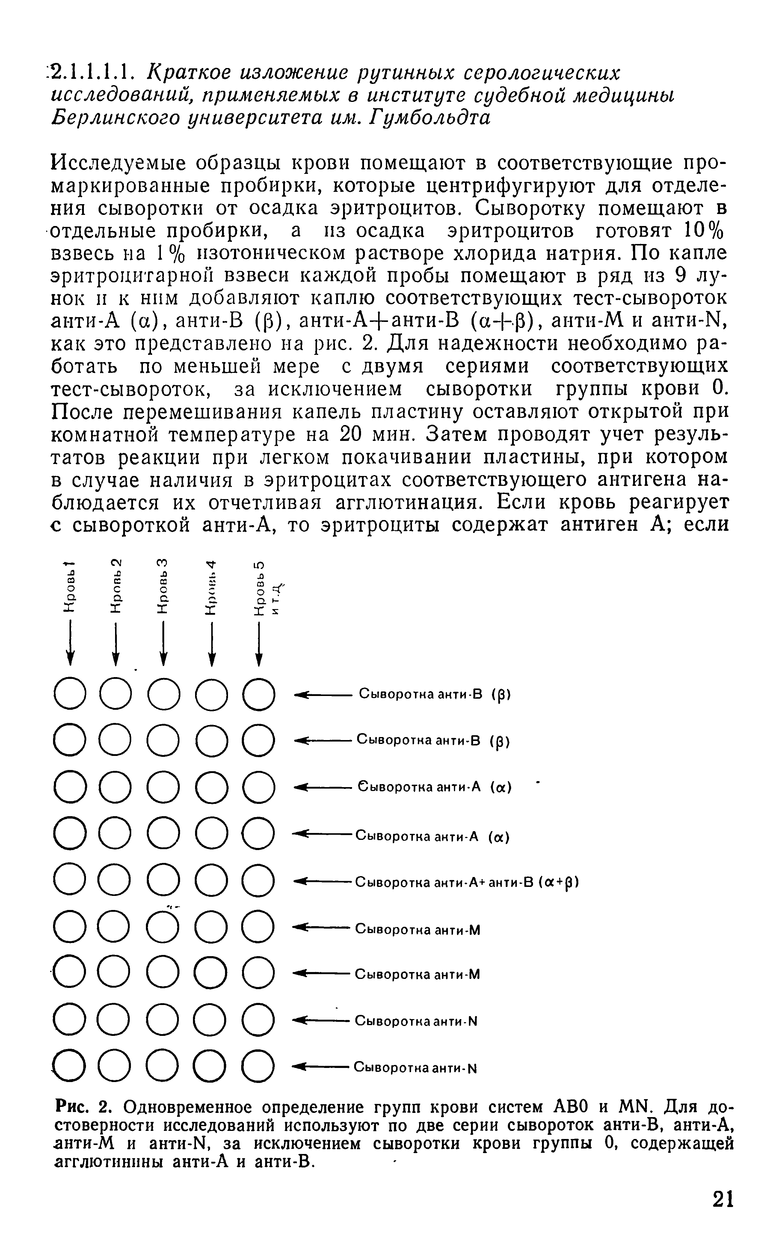 Рис. 2. Одновременное определение групп крови систем ABO и MN. Для достоверности исследований используют по две серии сывороток анти-В, анти-А, знти-М и анти-N, за исключением сыворотки крови группы 0, содержащей агглютинины анти-А и анти-В.