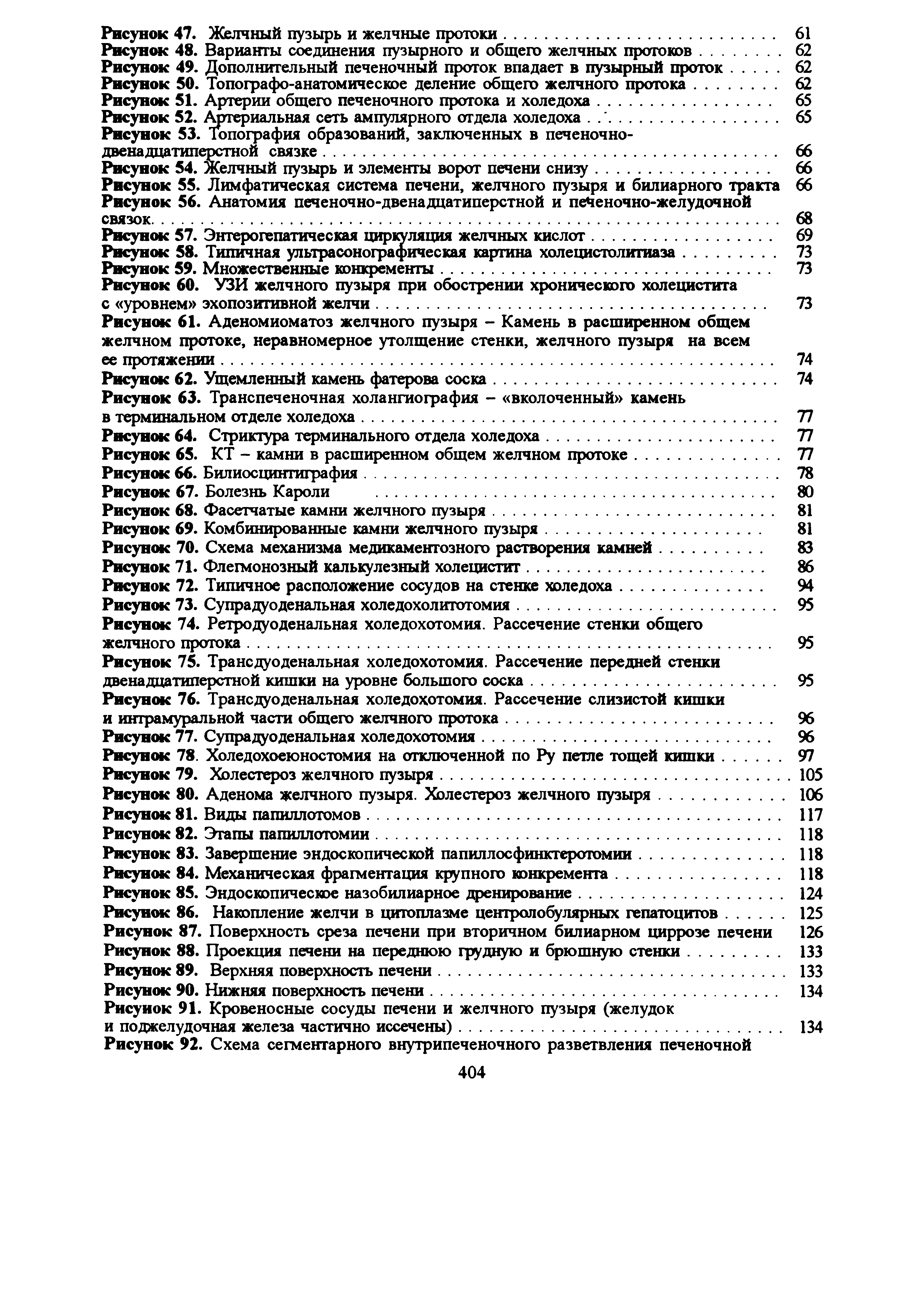 Рисунок 78. Холедохоеюностомия на отключенной по Ру петле тощей кишки. 97...